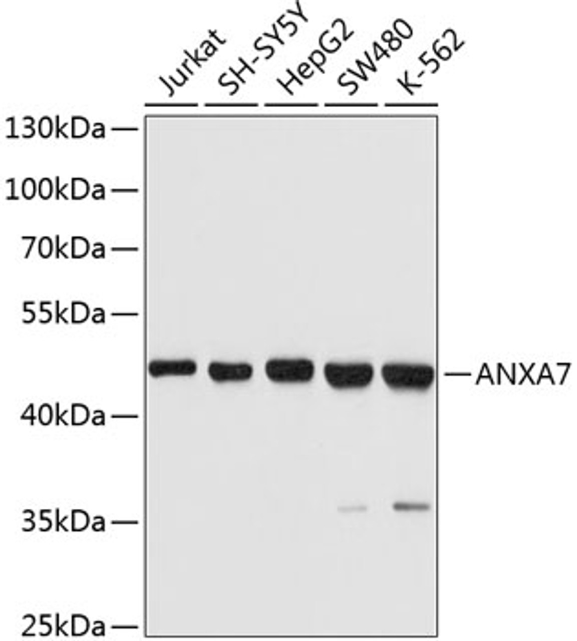 Western blot analysis of extracts of various cell lines, using ANXA7 Antibody (13-781) at 1:1000 dilution.<br/>Secondary antibody: HRP Goat Anti-Rabbit IgG (H+L) at 1:10000 dilution.<br/>Lysates/proteins: 25ug per lane.<br/>Blocking buffer: 3% nonfat dry milk in TBST.<br/>Detection: ECL Basic Kit.<br/>Exposure time: 10s.