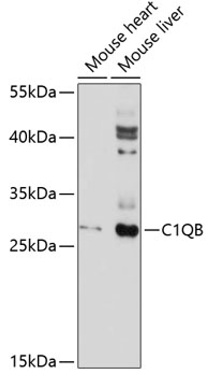 Western blot analysis of extracts of various cell lines, using C1QB antibody (13-835) at 1:1000 dilution.<br/>Secondary antibody: HRP Goat Anti-Rabbit IgG (H+L) at 1:10000 dilution.<br/>Lysates/proteins: 25ug per lane.<br/>Blocking buffer: 3% nonfat dry milk in TBST.<br/>Detection: ECL Enhanced Kit.<br/>Exposure time: 90s.