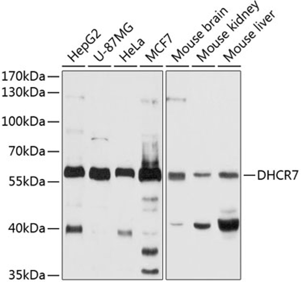Western blot analysis of extracts of various cell lines, using DHCR7 antibody (13-839) at 1:1000 dilution.<br/>Secondary antibody: HRP Goat Anti-Rabbit IgG (H+L) at 1:10000 dilution.<br/>Lysates/proteins: 25ug per lane.<br/>Blocking buffer: 3% nonfat dry milk in TBST.<br/>Detection: ECL Basic Kit.<br/>Exposure time: 30s.