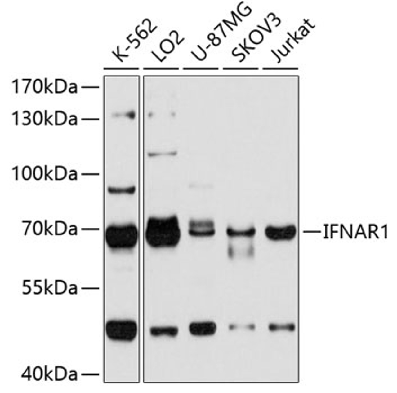 Western blot analysis of extracts of various cell lines, using IFNAR1 antibody (13-841) at 1:1000 dilution.<br/>Secondary antibody: HRP Goat Anti-Rabbit IgG (H+L) at 1:10000 dilution.<br/>Lysates/proteins: 25ug per lane.<br/>Blocking buffer: 3% nonfat dry milk in TBST.<br/>Detection: ECL Basic Kit.<br/>Exposure time: 15s.