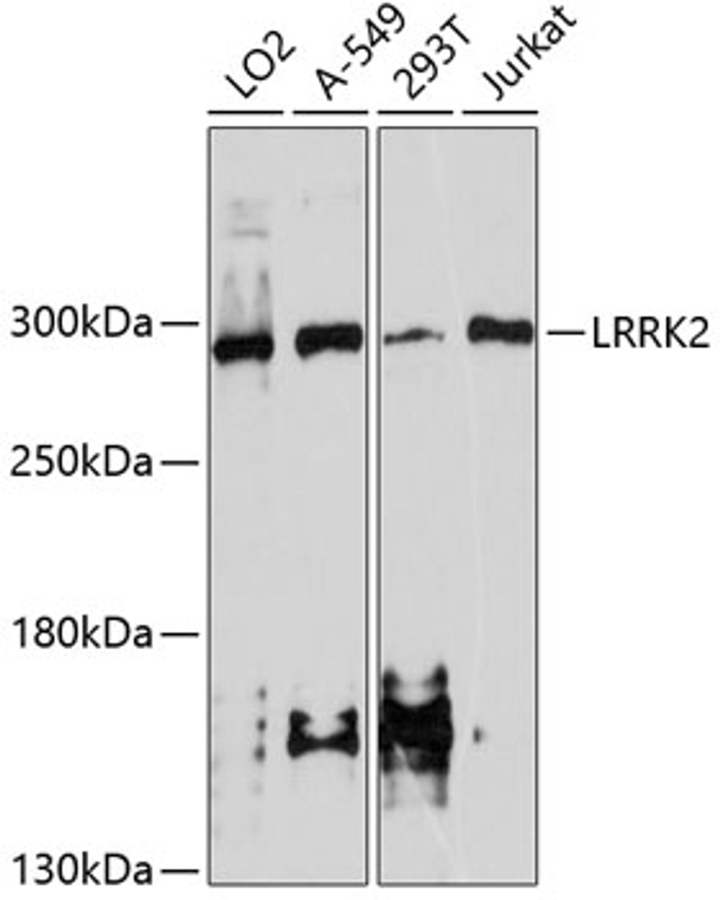 Western blot analysis of extracts of various cell lines, using LRRK2 antibody (13-870) at 1:1000 dilution.<br/>Secondary antibody: HRP Goat Anti-Rabbit IgG (H+L) at 1:10000 dilution.<br/>Lysates/proteins: 25ug per lane.<br/>Blocking buffer: 3% nonfat dry milk in TBST.<br/>Detection: ECL Enhanced Kit.<br/>Exposure time: 90s.