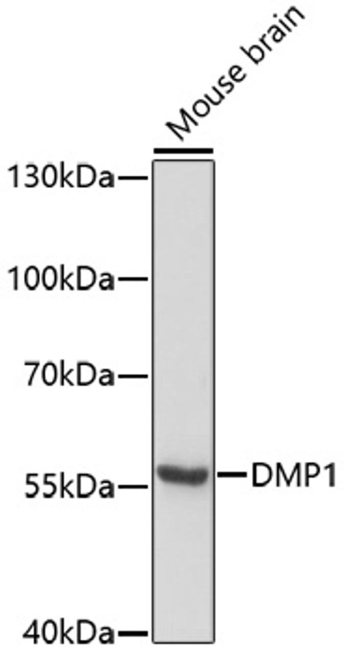 Western blot analysis of extracts of mouse brain, using DMP1 antibody (13-903) at 1:1000 dilution.<br/>Secondary antibody: HRP Goat Anti-Rabbit IgG (H+L) at 1:10000 dilution.<br/>Lysates/proteins: 25ug per lane.<br/>Blocking buffer: 3% nonfat dry milk in TBST.<br/>Detection: ECL Basic Kit.<br/>Exposure time: 5min.