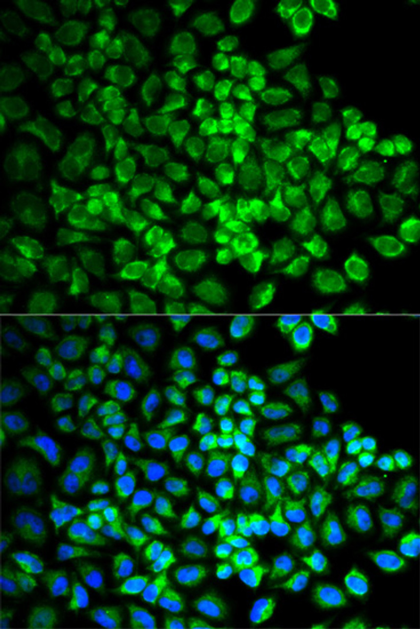 Immunofluorescence analysis of U2OS cells using GRIA3 antibody (14-058) . Blue: DAPI for nuclear staining.