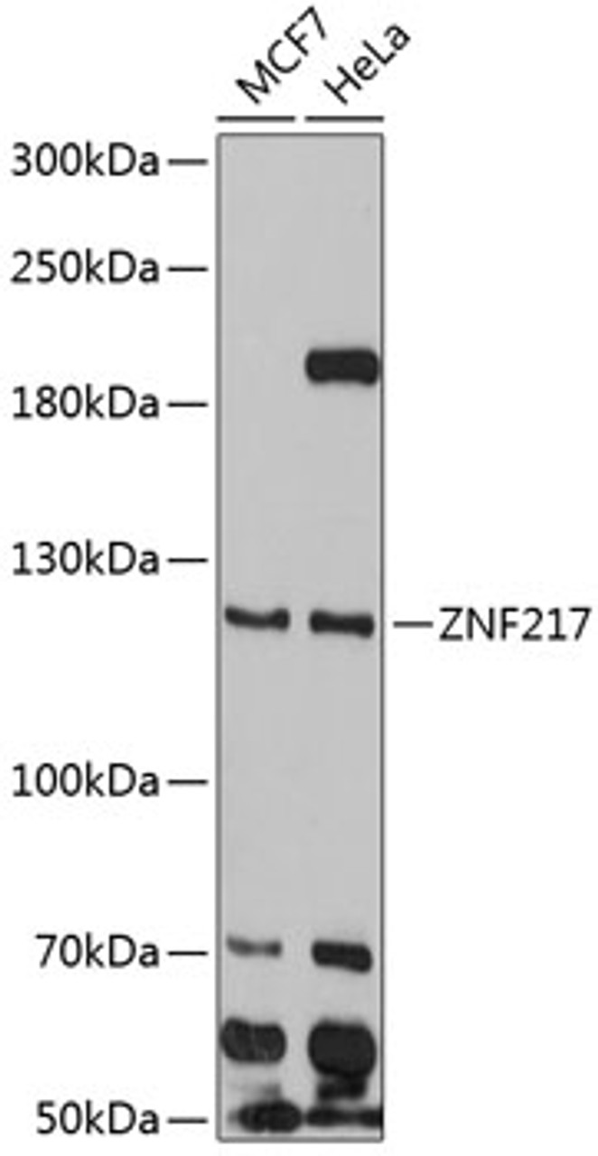 Western blot analysis of extracts of various cell lines, using ZNF217 antibody (14-151) at 1:1000 dilution.<br/>Secondary antibody: HRP Goat Anti-Rabbit IgG (H+L) at 1:10000 dilution.<br/>Lysates/proteins: 25ug per lane.<br/>Blocking buffer: 3% nonfat dry milk in TBST.<br/>Detection: ECL Enhanced Kit.<br/>Exposure time: 90s.