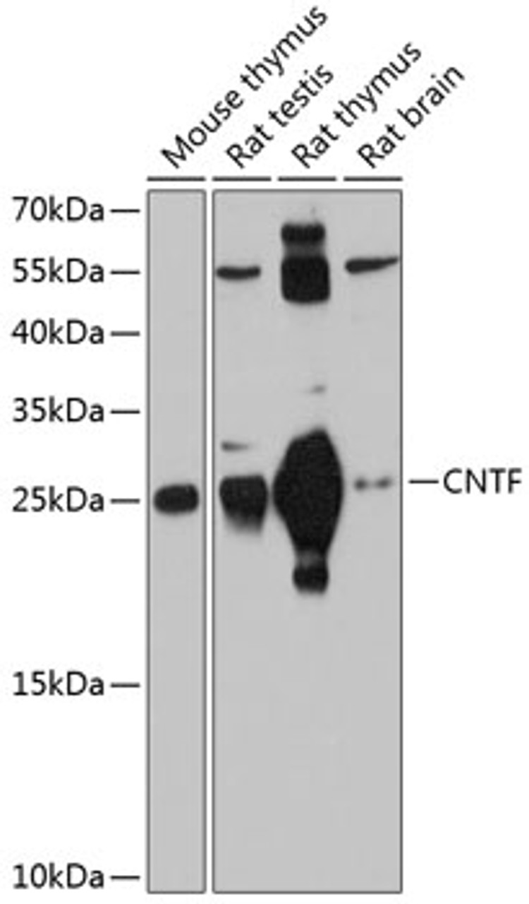 Western blot analysis of extracts of various cell lines, using CNTF antibody (14-154) at 1:1000 dilution.<br/>Secondary antibody: HRP Goat Anti-Rabbit IgG (H+L) at 1:10000 dilution.<br/>Lysates/proteins: 25ug per lane.<br/>Blocking buffer: 3% nonfat dry milk in TBST.<br/>Detection: ECL Basic Kit.<br/>Exposure time: 90s.