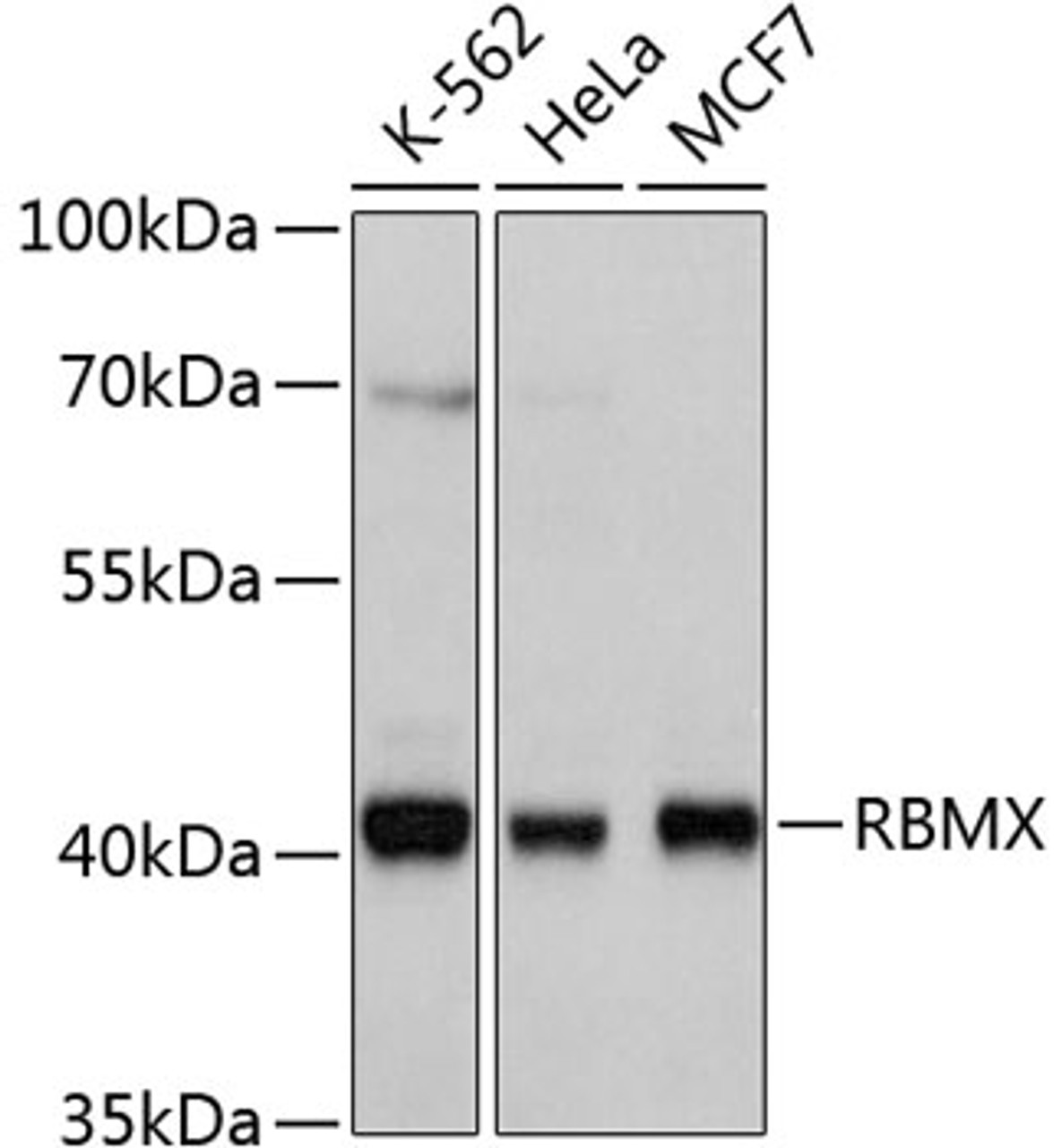 Western blot analysis of extracts of various cell lines, using RBMX antibody (14-159) at 1:1000 dilution.<br/>Secondary antibody: HRP Goat Anti-Rabbit IgG (H+L) at 1:10000 dilution.<br/>Lysates/proteins: 25ug per lane.<br/>Blocking buffer: 3% nonfat dry milk in TBST.<br/>Detection: ECL Basic Kit.<br/>Exposure time: 1s.