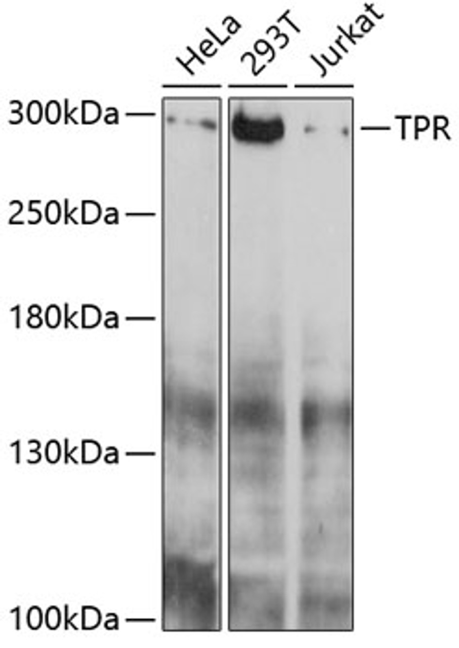 Western blot analysis of extracts of various cell lines, using TPR antibody (14-160) at 1:1000 dilution.<br/>Secondary antibody: HRP Goat Anti-Rabbit IgG (H+L) at 1:10000 dilution.<br/>Lysates/proteins: 25ug per lane.<br/>Blocking buffer: 3% nonfat dry milk in TBST.<br/>Detection: ECL Basic Kit.<br/>Exposure time: 30s.