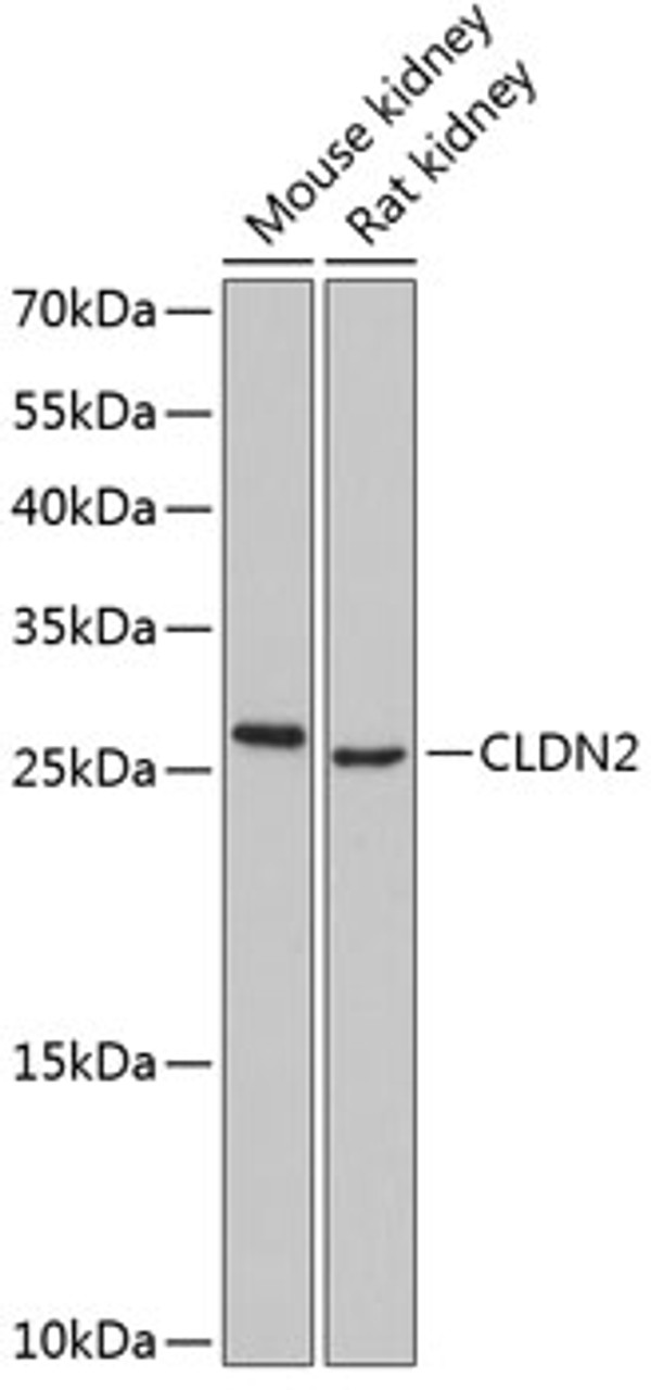 Western blot analysis of extracts of various cell lines, using CLDN2 antibody (14-167) at 1:1000 dilution.<br/>Secondary antibody: HRP Goat Anti-Rabbit IgG (H+L) at 1:10000 dilution.<br/>Lysates/proteins: 25ug per lane.<br/>Blocking buffer: 3% nonfat dry milk in TBST.<br/>Detection: ECL Basic Kit.<br/>Exposure time: 90s.