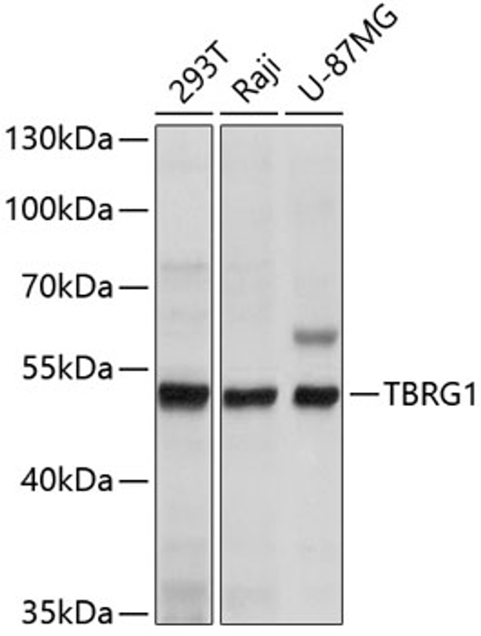 Western blot analysis of extracts of various cell lines, using TBRG1 antibody (14-168) at 1:1000 dilution.<br/>Secondary antibody: HRP Goat Anti-Rabbit IgG (H+L) at 1:10000 dilution.<br/>Lysates/proteins: 25ug per lane.<br/>Blocking buffer: 3% nonfat dry milk in TBST.<br/>Detection: ECL Basic Kit.<br/>Exposure time: 3s.