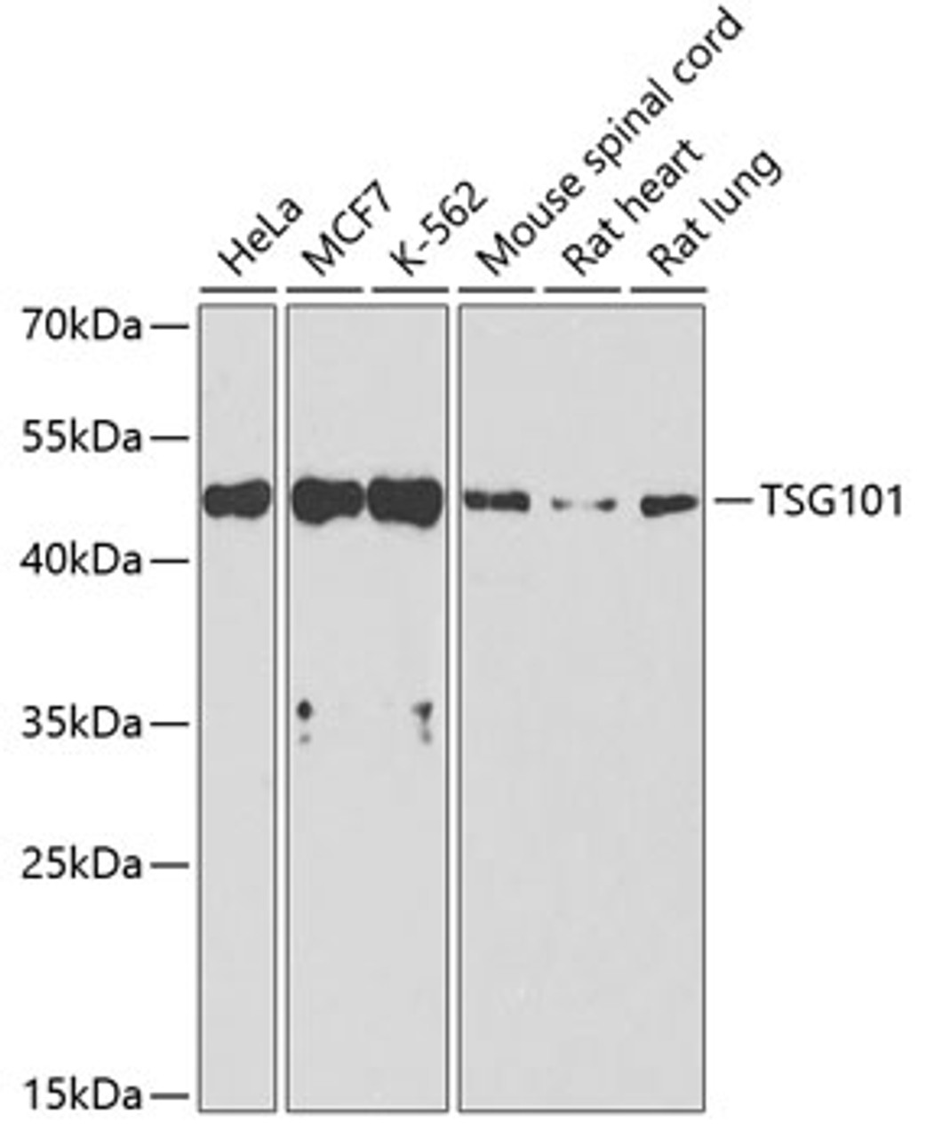 Western blot analysis of extracts of various cell lines, using TSG101 antibody (16-799) at 1:1000 dilution.<br/>Secondary antibody: HRP Goat Anti-Rabbit IgG (H+L) at 1:10000 dilution.<br/>Lysates/proteins: 25ug per lane.<br/>Blocking buffer: 3% nonfat dry milk in TBST.<br/>Detection: ECL Basic Kit.<br/>Exposure time: 40s.