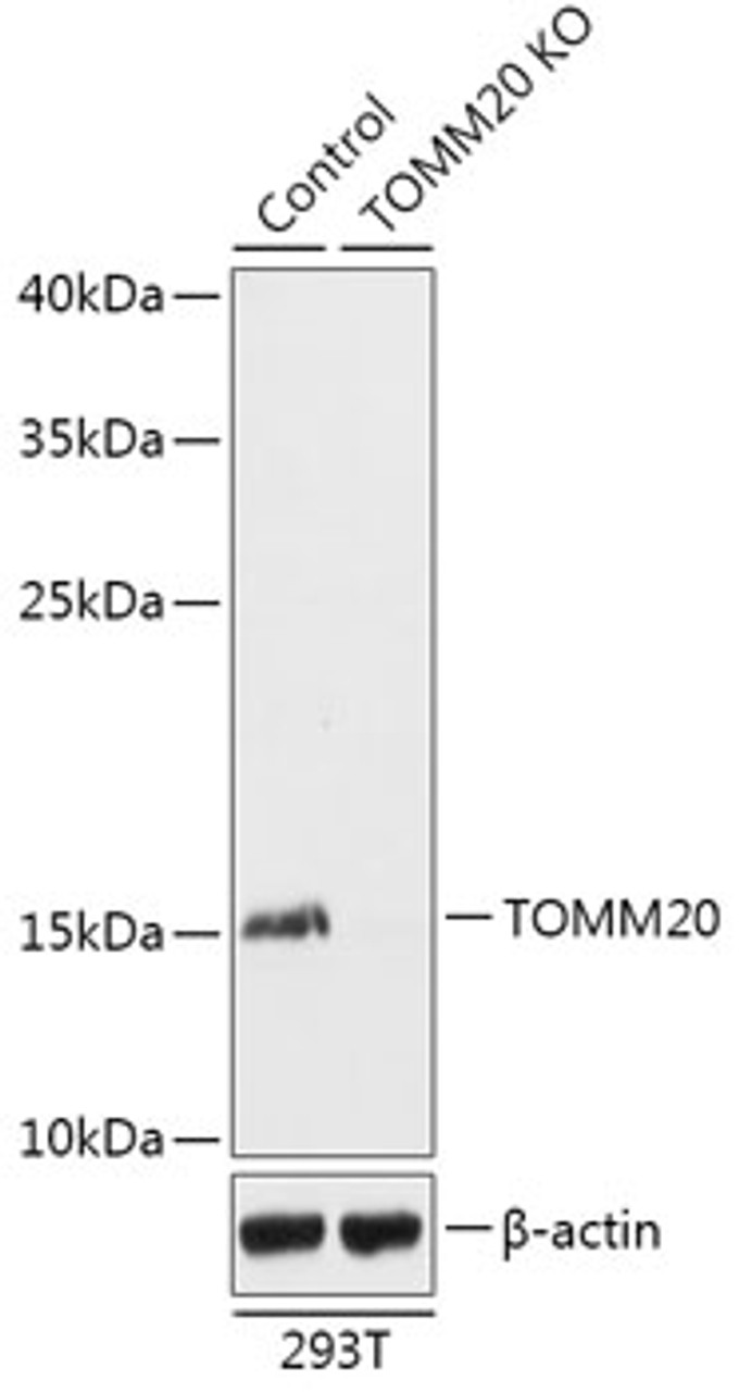 Western blot analysis of extracts from normal (control) and TOMM20 knockout (KO) 293T cells, using TOMM20 antibody (18-235) at 1:1000 dilution.<br/>Secondary antibody: HRP Goat Anti-Rabbit IgG (H+L) at 1:10000 dilution.<br/>Lysates/proteins: 25ug per lane.<br/>Blocking buffer: 3% nonfat dry milk in TBST.<br/>Detection: ECL Basic Kit.<br/>Exposure time: 1s.