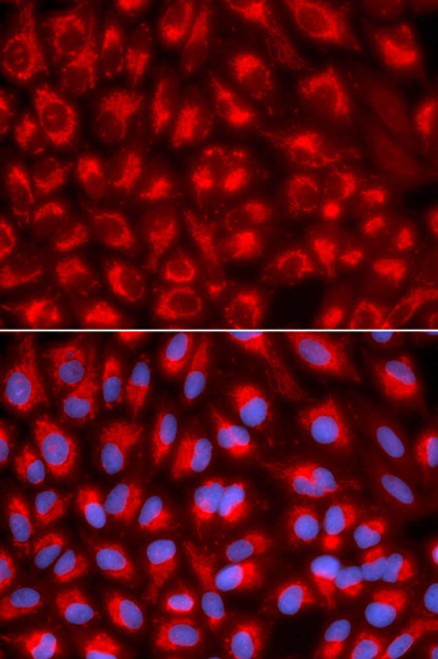 Immunofluorescence analysis of U2OS cells using TFAM antibody (18-390) . Blue: DAPI for nuclear staining.