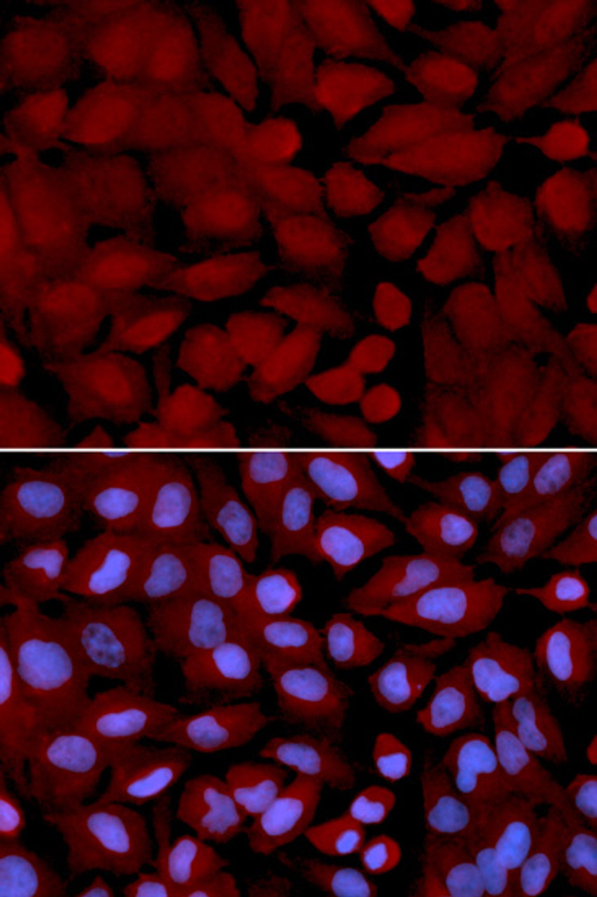 Immunofluorescence analysis of U2OS cells using OGT antibody (18-433) . Blue: DAPI for nuclear staining.