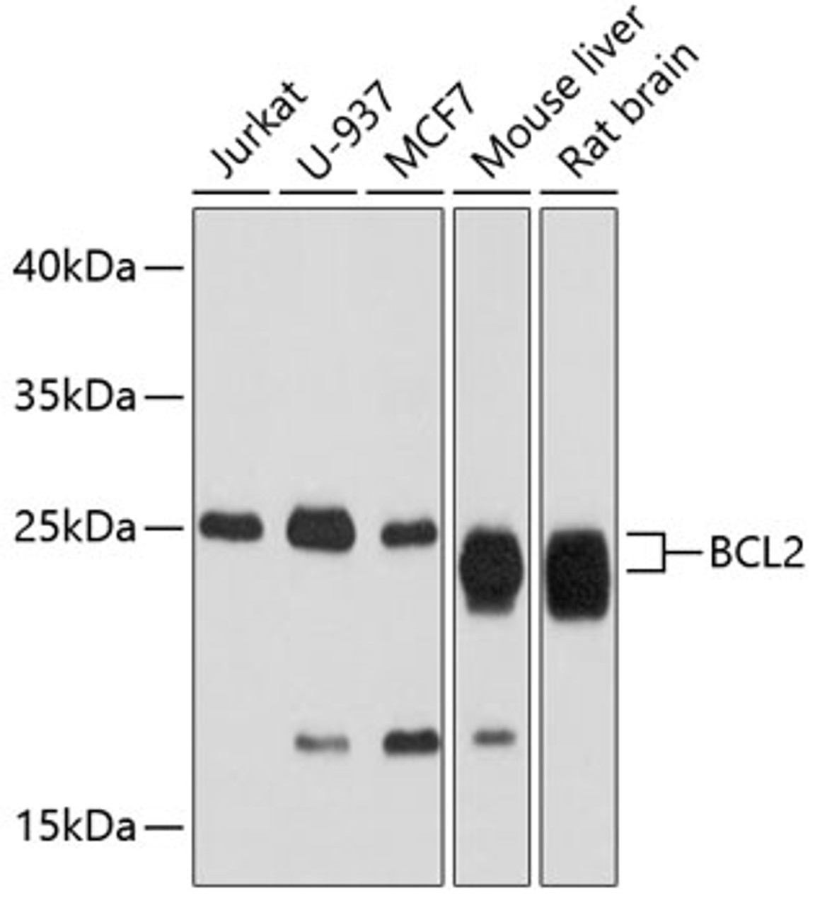 Western blot analysis of extracts of various cell lines, using BCL2 antibody (18-575) at 1:2000 dilution.<br/>Secondary antibody: HRP Goat Anti-Rabbit IgG (H+L) at 1:10000 dilution.<br/>Lysates/proteins: 25ug per lane.<br/>Blocking buffer: 3% nonfat dry milk in TBST.<br/>Detection: ECL Basic Kit.<br/>Exposure time: 90s.