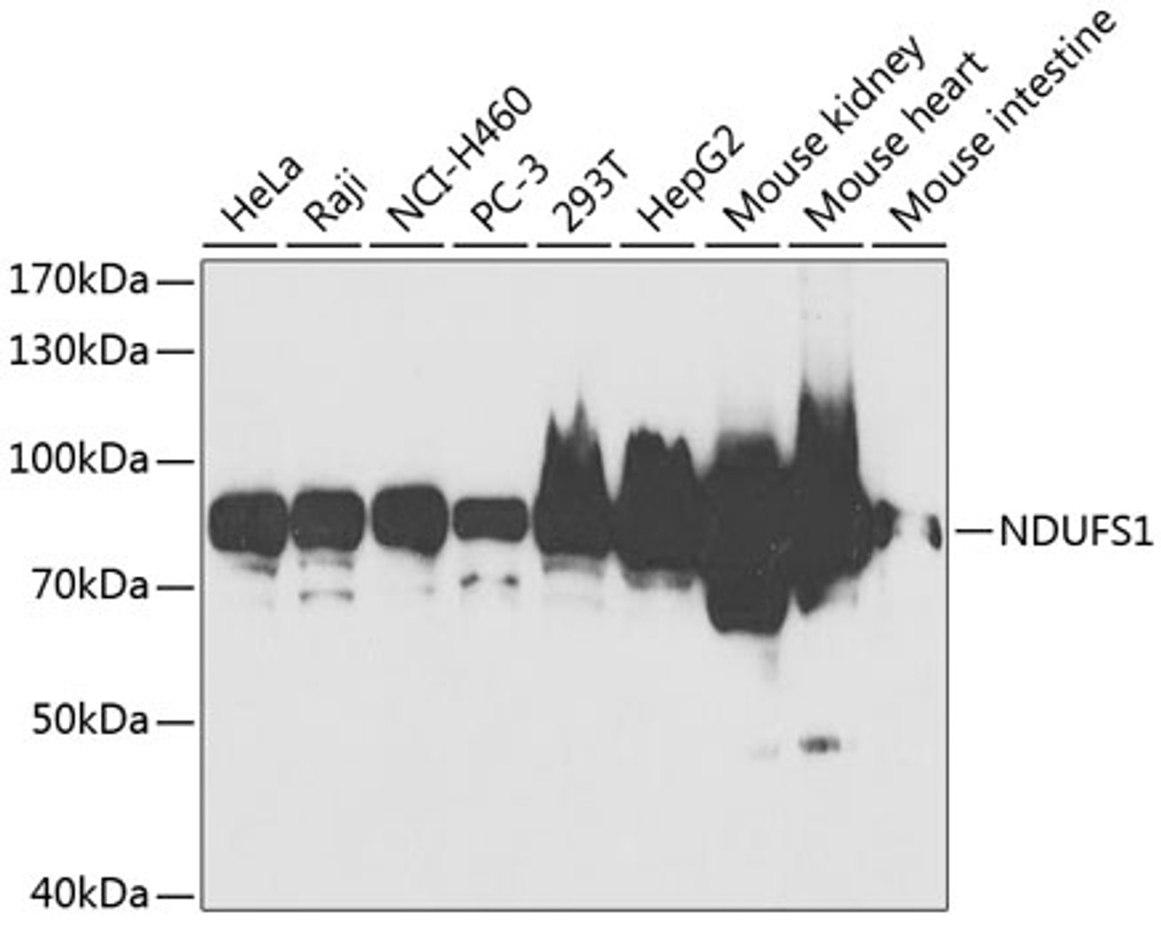 Western blot analysis of extracts of various cell lines, using NDUFS1 antibody (18-729) at 1:1000 dilution.<br/>Secondary antibody: HRP Goat Anti-Rabbit IgG (H+L) at 1:10000 dilution.<br/>Lysates/proteins: 25ug per lane.<br/>Blocking buffer: 3% nonfat dry milk in TBST.<br/>Detection: ECL Basic Kit.<br/>Exposure time: 90s.