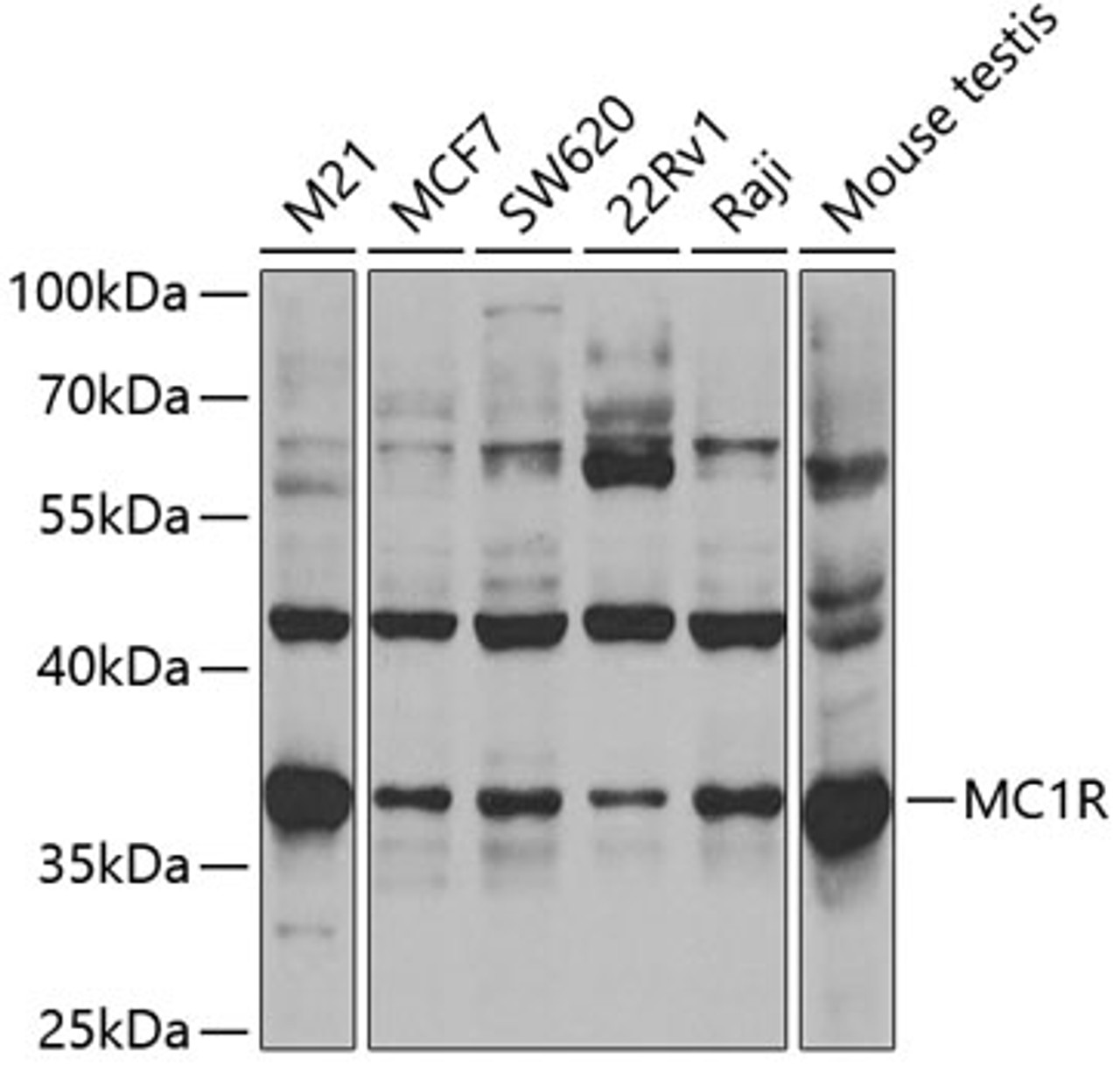 Western blot analysis of extracts of various cell lines, using MC1R antibody (18-904) at 1:400 dilution.<br/>Secondary antibody: HRP Goat Anti-Rabbit IgG (H+L) at 1:10000 dilution.<br/>Lysates/proteins: 25ug per lane.<br/>Blocking buffer: 3% nonfat dry milk in TBST.<br/>Detection: ECL Enhanced Kit.<br/>Exposure time: 90s.