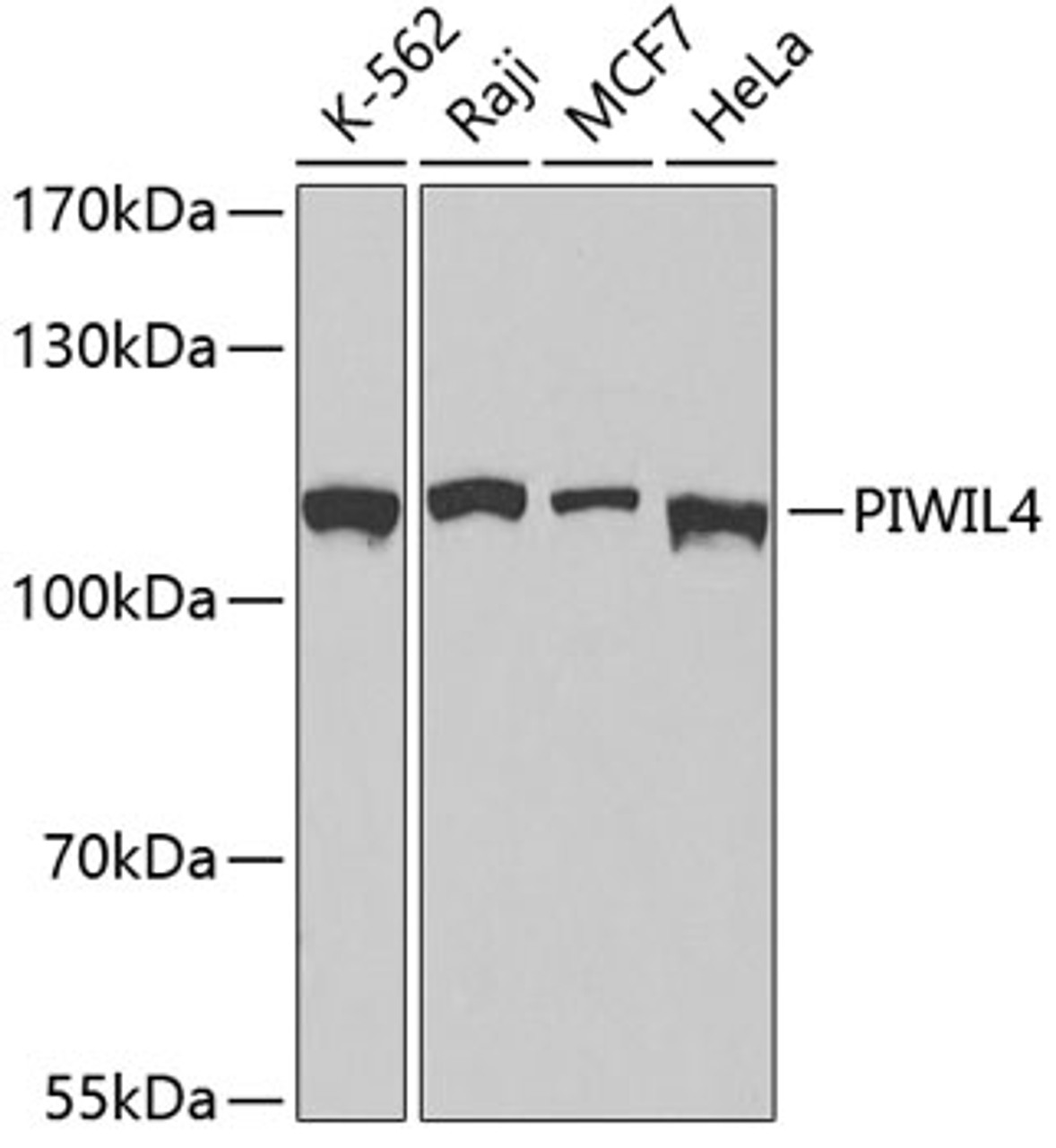 Western blot analysis of extracts of various cell lines, using PIWIL4 antibody (18-960) at 1:500 dilution.<br/>Secondary antibody: HRP Goat Anti-Rabbit IgG (H+L) at 1:10000 dilution.<br/>Lysates/proteins: 25ug per lane.<br/>Blocking buffer: 3% nonfat dry milk in TBST.<br/>Detection: ECL Basic Kit.<br/>Exposure time: 90s.