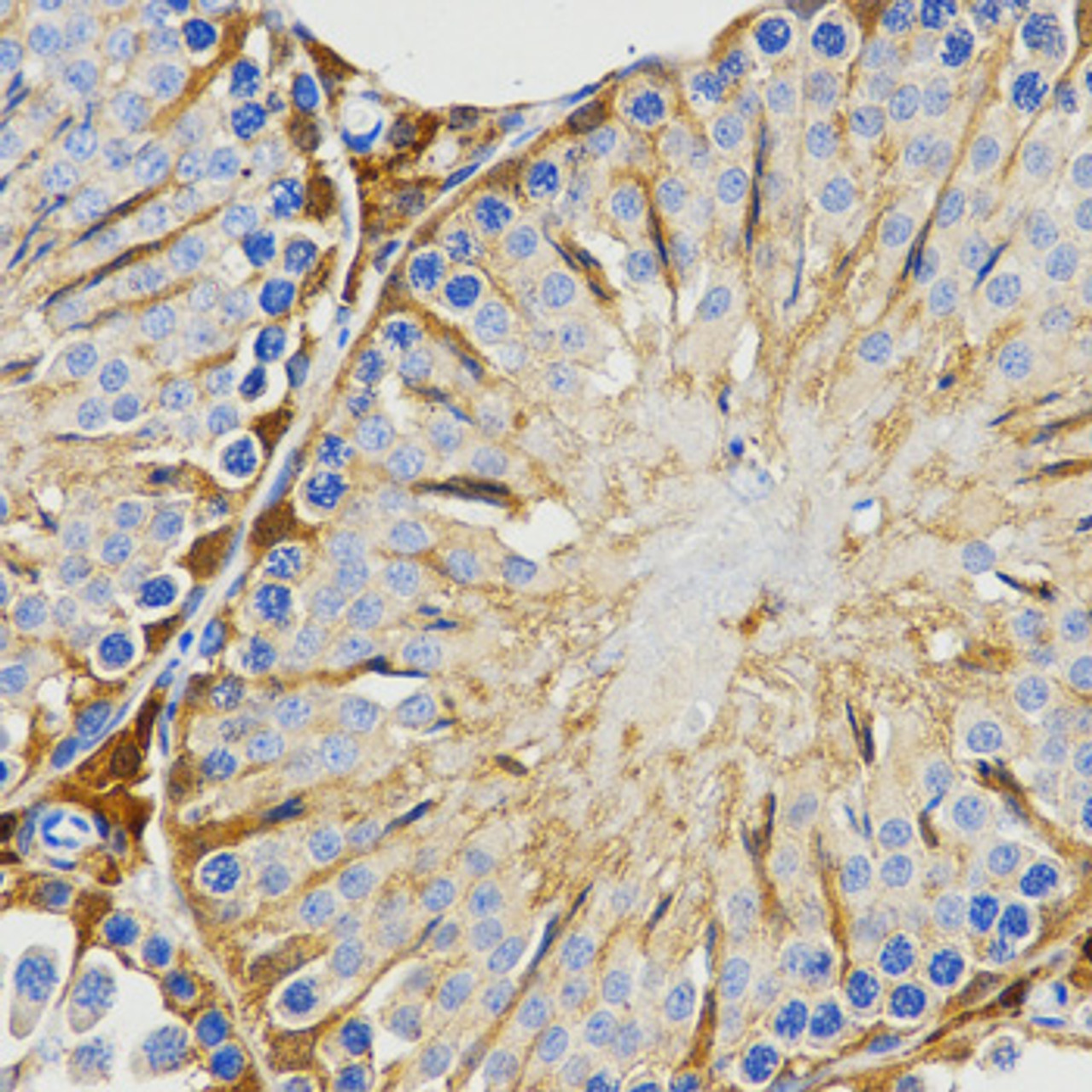 Immunohistochemistry of paraffin-embedded rat testis using PIWIL4 antibody (18-960) at dilution of 1:200 (40x lens) .