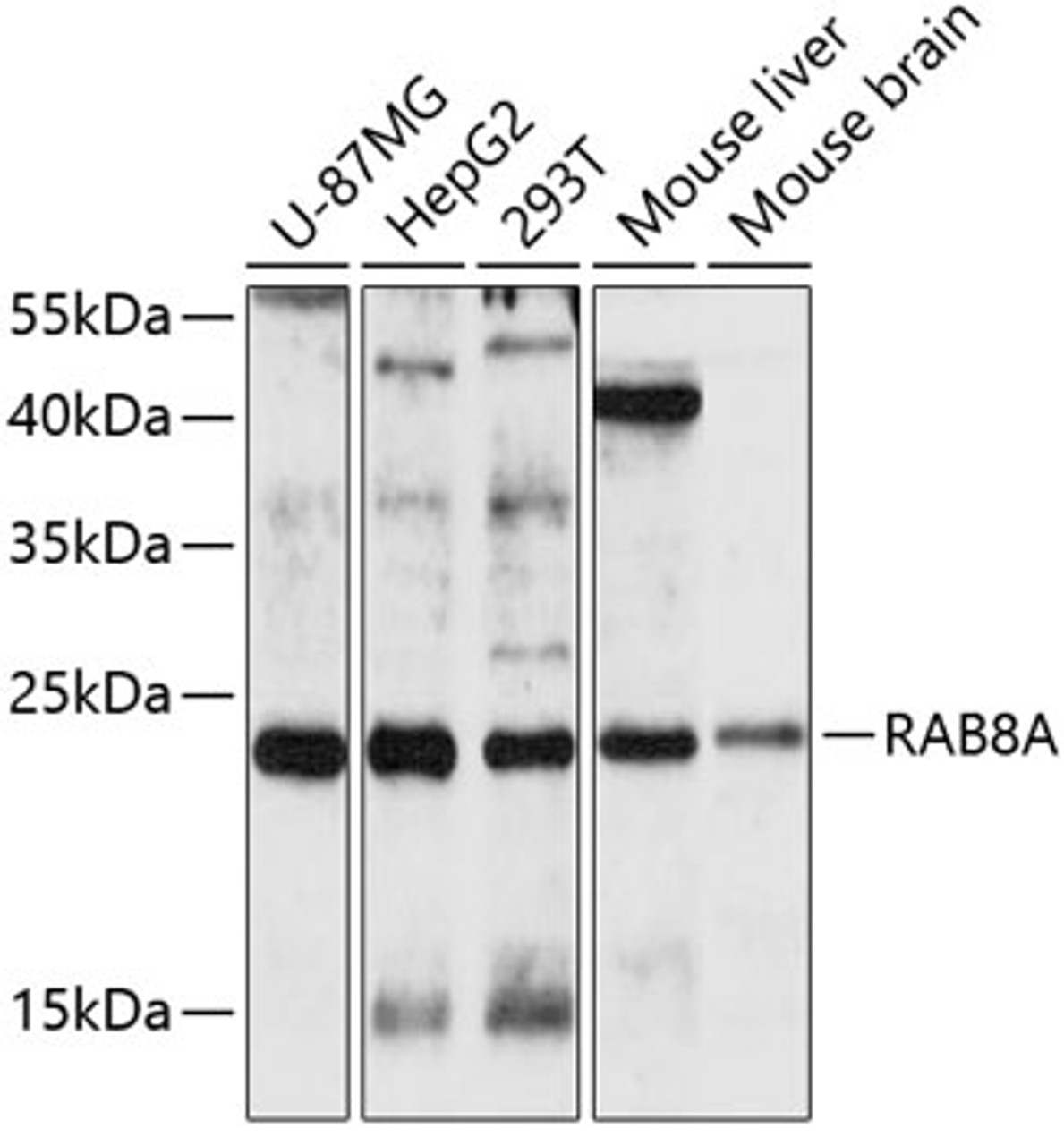 Western blot analysis of extracts of various cell lines, using RAB8A antibody (19-105) at 1:1000 dilution.<br/>Secondary antibody: HRP Goat Anti-Rabbit IgG (H+L) at 1:10000 dilution.<br/>Lysates/proteins: 25ug per lane.<br/>Blocking buffer: 3% nonfat dry milk in TBST.<br/>Detection: ECL Basic Kit.<br/>Exposure time: 90s.