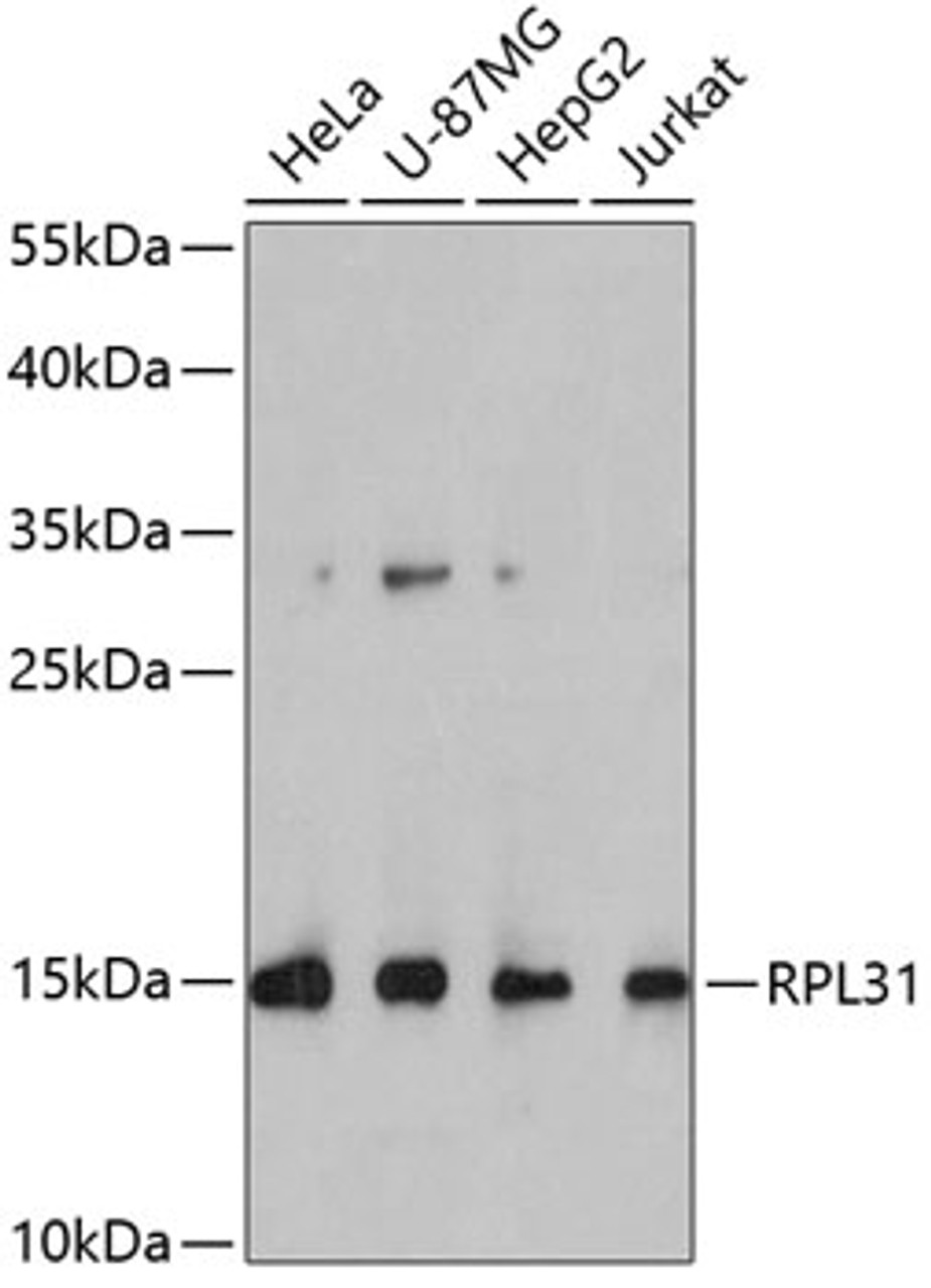 Western blot analysis of extracts of various cell lines, using RPL31 antibody (19-276) at 1:1000 dilution.<br/>Secondary antibody: HRP Goat Anti-Rabbit IgG (H+L) at 1:10000 dilution.<br/>Lysates/proteins: 25ug per lane.<br/>Blocking buffer: 3% nonfat dry milk in TBST.<br/>Detection: ECL Basic Kit.<br/>Exposure time: 90s.