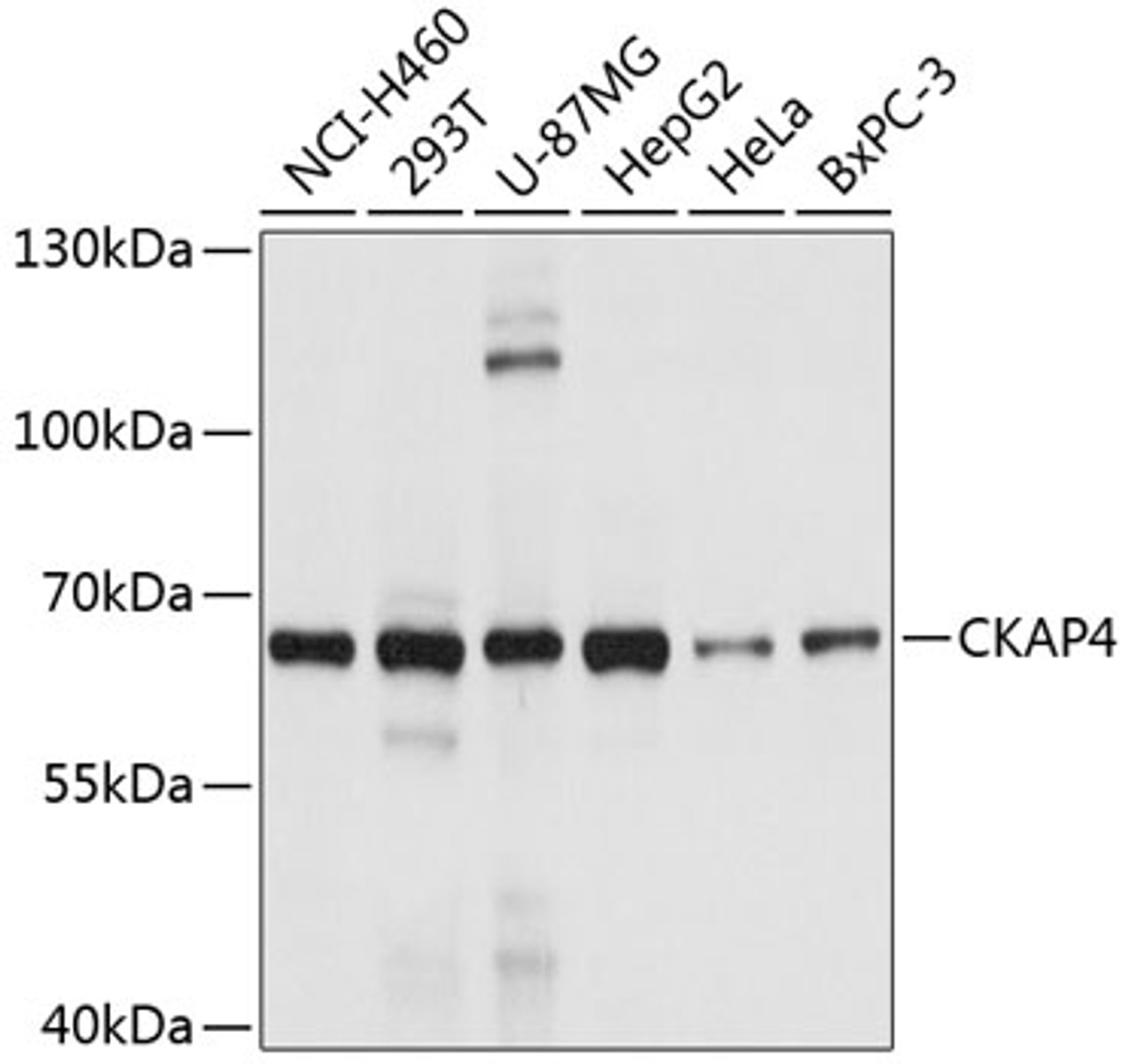 Western blot analysis of extracts of various cell lines, using CKAP4 antibody (19-386) at 1:1000 dilution.<br/>Secondary antibody: HRP Goat Anti-Rabbit IgG (H+L) at 1:10000 dilution.<br/>Lysates/proteins: 25ug per lane.<br/>Blocking buffer: 3% nonfat dry milk in TBST.<br/>Detection: ECL Basic Kit.<br/>Exposure time: 5s.