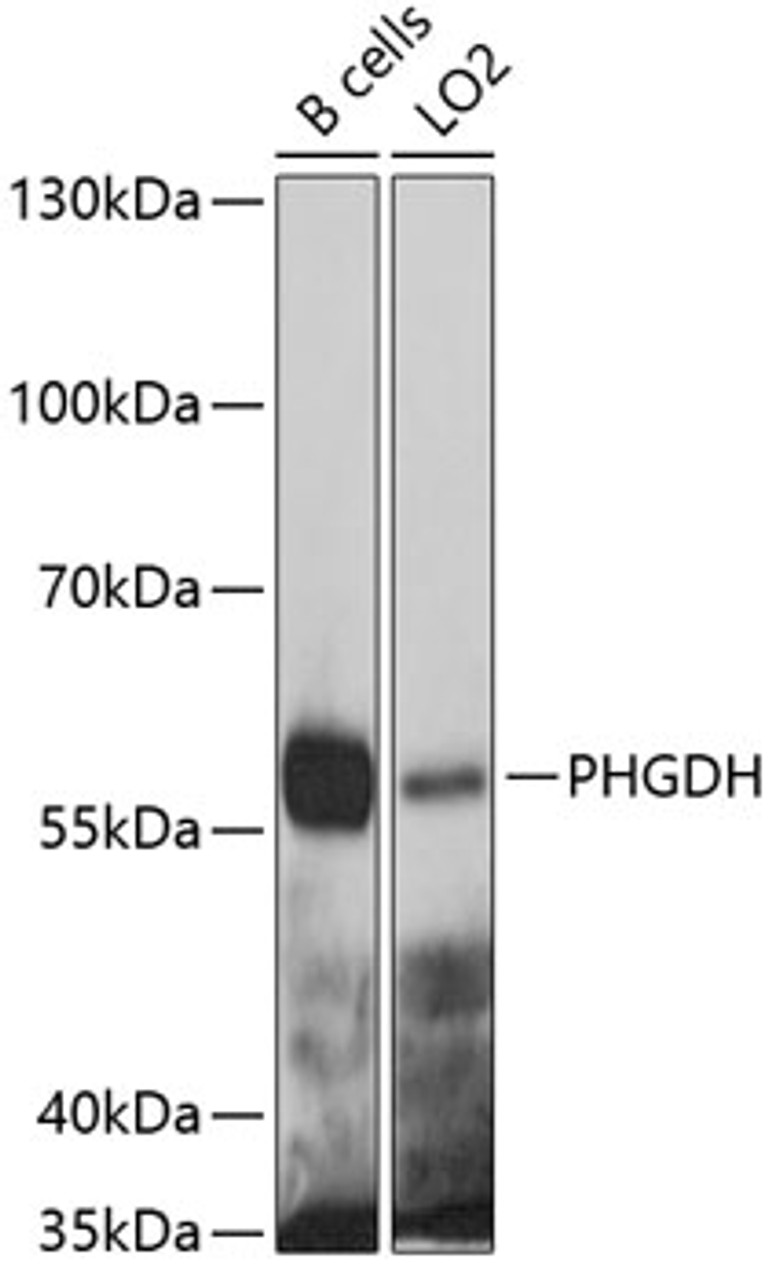 Western blot analysis of extracts of various cell lines, using PHGDH antibody (19-428) at 1:1000 dilution.<br/>Secondary antibody: HRP Goat Anti-Rabbit IgG (H+L) at 1:10000 dilution.<br/>Lysates/proteins: 25ug per lane.<br/>Blocking buffer: 3% nonfat dry milk in TBST.<br/>Detection: ECL Basic Kit.<br/>Exposure time: 5s.