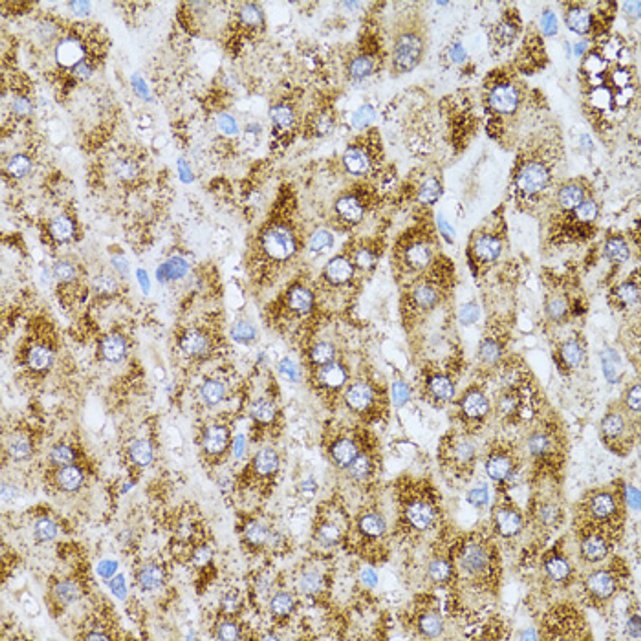 Immunohistochemistry of paraffin-embedded human liver using CAT antibody (19-557) at dilution of 1:100 (40x lens) .