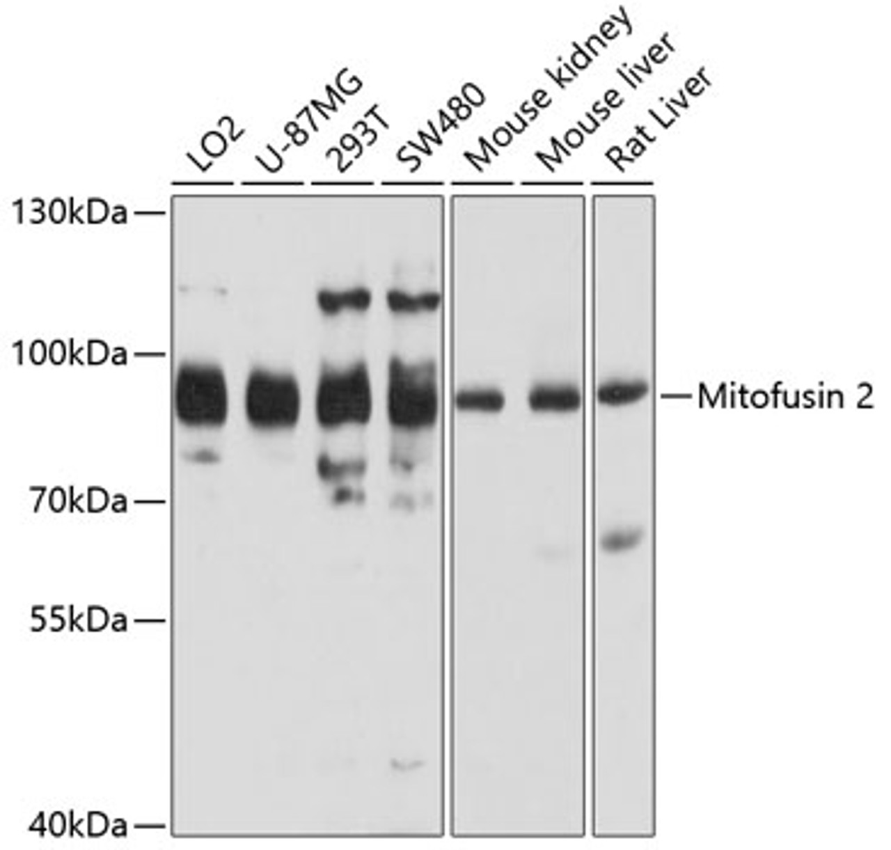 Western blot analysis of extracts of various cell lines, using Mitofusin 2 antibody (19-833) at 1:1000 dilution.<br/>Secondary antibody: HRP Goat Anti-Rabbit IgG (H+L) at 1:10000 dilution.<br/>Lysates/proteins: 25ug per lane.<br/>Blocking buffer: 3% nonfat dry milk in TBST.<br/>Detection: ECL Basic Kit.<br/>Exposure time: 5s.