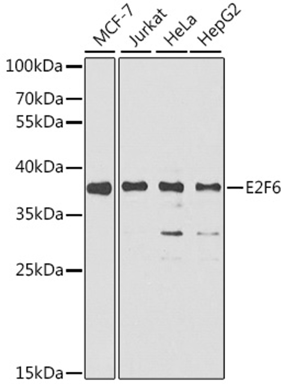 Western blot analysis of extracts of various cell lines, using E2F6 antibody (22-034) at 1:1000 dilution.<br/>Secondary antibody: HRP Goat Anti-Rabbit IgG (H+L) at 1:10000 dilution.<br/>Lysates/proteins: 25ug per lane.<br/>Blocking buffer: 3% nonfat dry milk in TBST.<br/>Detection: ECL Basic Kit.<br/>Exposure time: 90s.