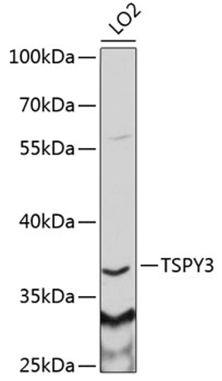 Western blot analysis of extracts of LO2 cells, using TSPY3 antibody (22-094) at 1:1000 dilution.<br/>Secondary antibody: HRP Goat Anti-Rabbit IgG (H+L) at 1:10000 dilution.<br/>Lysates/proteins: 25ug per lane.<br/>Blocking buffer: 3% nonfat dry milk in TBST.<br/>Detection: ECL Basic Kit.<br/>Exposure time: 30s.