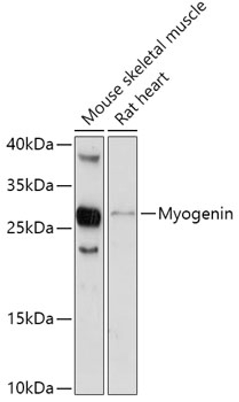 Western blot analysis of extracts of various cell lines, using MYOG antibody (22-390) at 1:1000 dilution.<br/>Secondary antibody: HRP Goat Anti-Rabbit IgG (H+L) at 1:10000 dilution.<br/>Lysates/proteins: 25ug per lane.<br/>Blocking buffer: 3% nonfat dry milk in TBST.<br/>Detection: ECL Basic Kit.<br/>Exposure time: 15s.