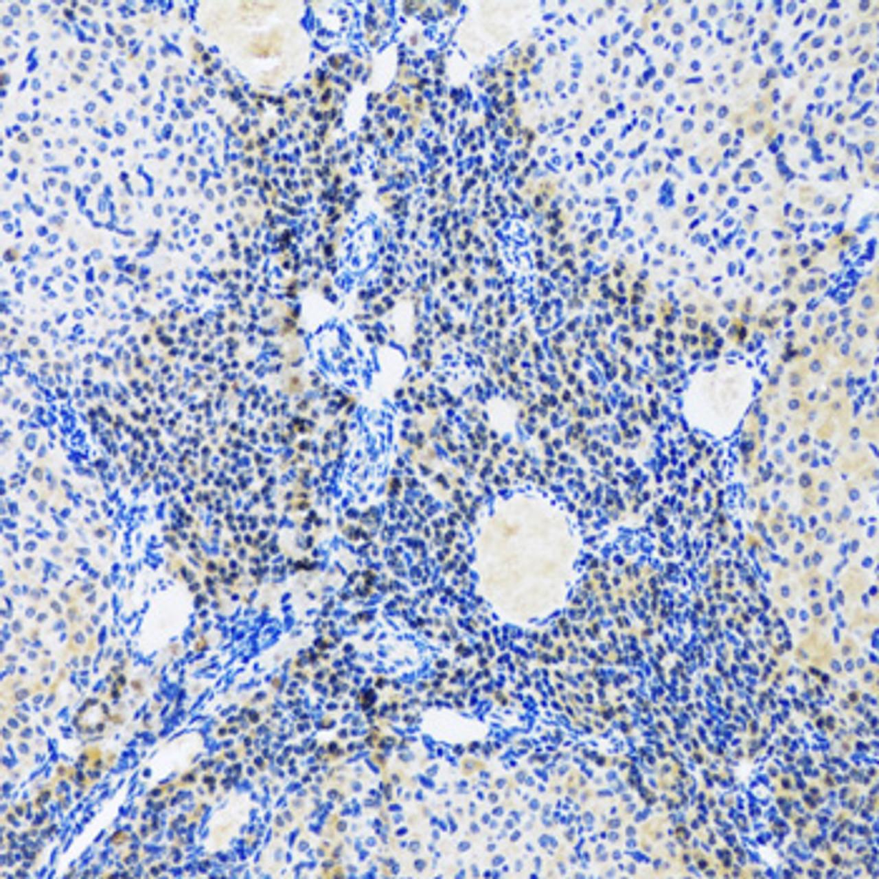 Immunohistochemistry of paraffin-embedded rat ovary using Myogenin antibody (22-390) at dilution of 1:100 (20x lens) .