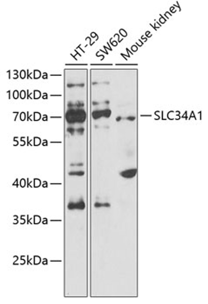 Western blot analysis of extracts of various cell lines, using SLC34A1 antibody (22-453) at 1:1000 dilution.<br/>Secondary antibody: HRP Goat Anti-Rabbit IgG (H+L) at 1:10000 dilution.<br/>Lysates/proteins: 25ug per lane.<br/>Blocking buffer: 3% nonfat dry milk in TBST.<br/>Detection: ECL Basic Kit.<br/>Exposure time: 30s.
