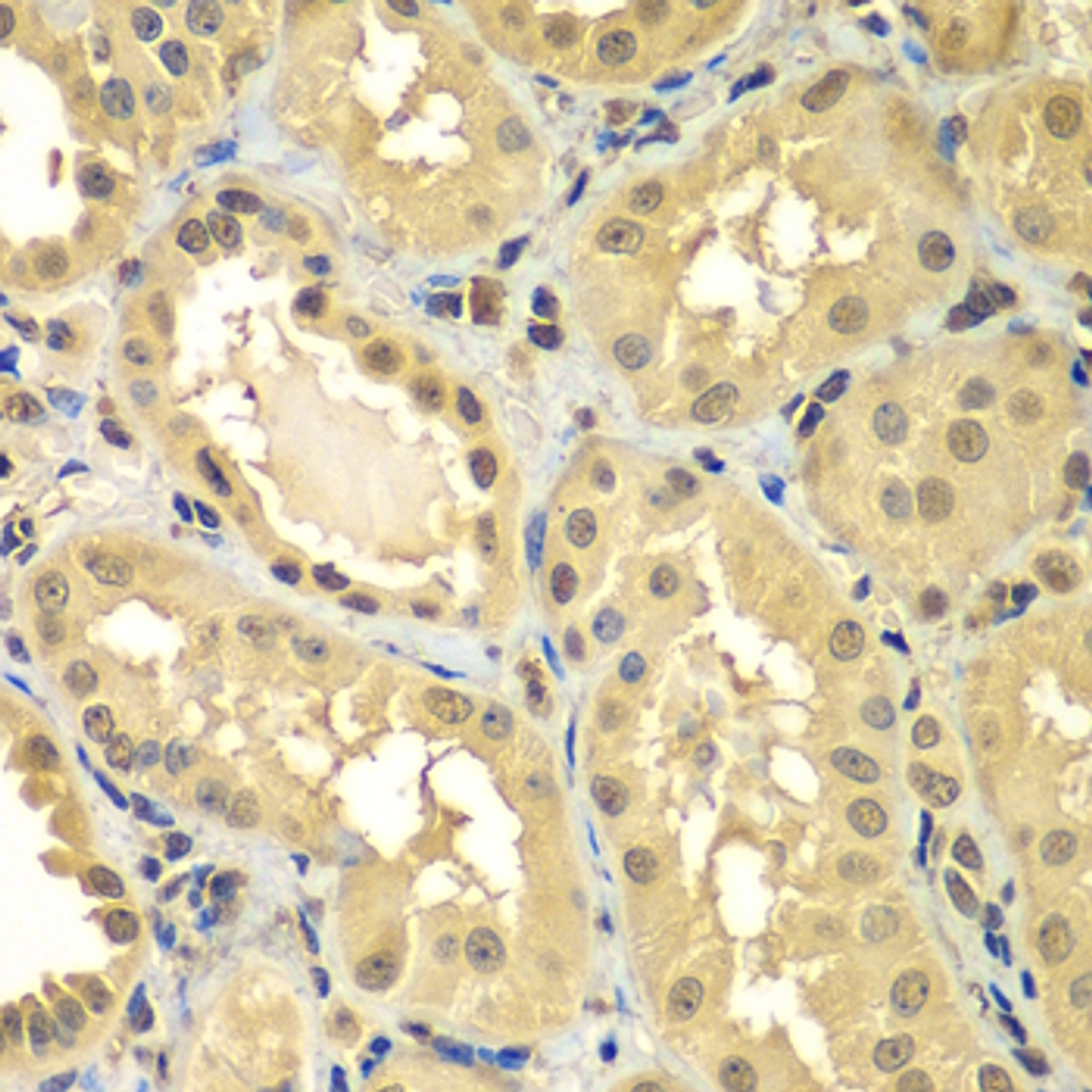 Immunohistochemistry of paraffin-embedded human kidney using SMAD2/SMAD3 antibody (23-013) at dilution of 1:100 (40x lens) .