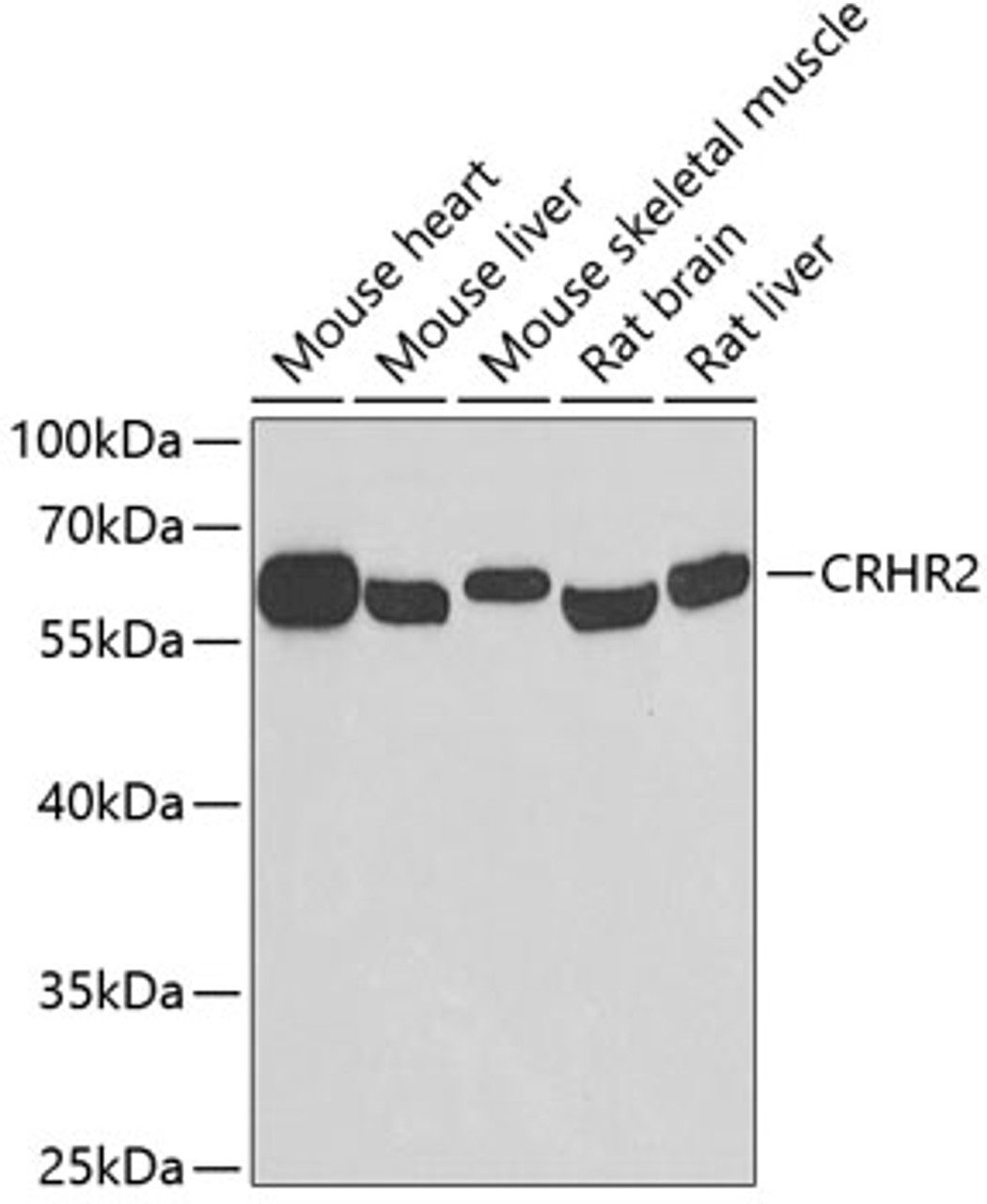 Western blot analysis of extracts of various cell lines, using CRHR2 antibody (23-087) at 1:500 dilution.<br/>Secondary antibody: HRP Goat Anti-Rabbit IgG (H+L) at 1:10000 dilution.<br/>Lysates/proteins: 25ug per lane.<br/>Blocking buffer: 3% nonfat dry milk in TBST.<br/>Detection: ECL Basic Kit.<br/>Exposure time: 90s.