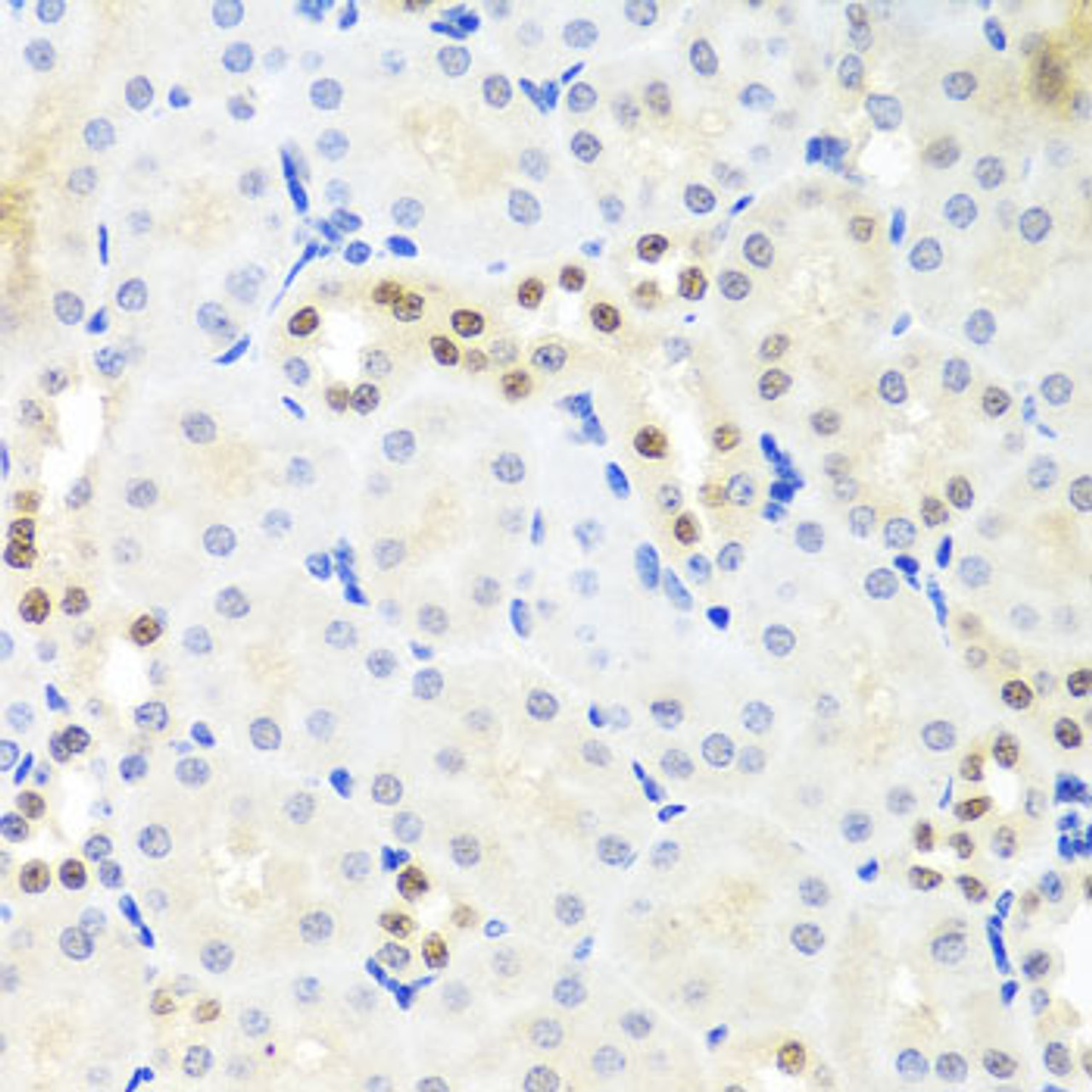 Immunohistochemistry of paraffin-embedded mouse kidney using DDX39A antibody (23-308) at dilution of 1:100 (40x lens) .