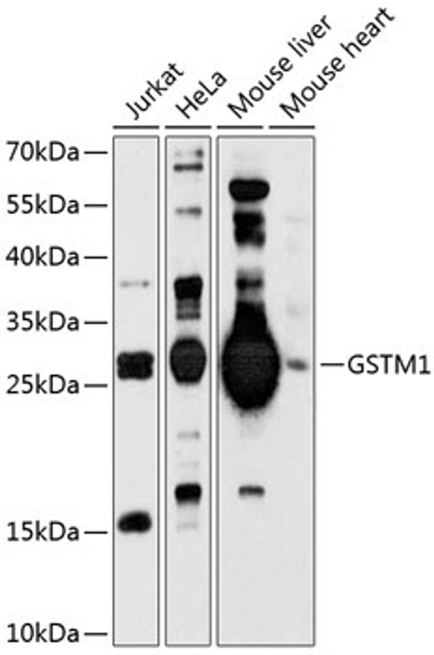 Western blot analysis of extracts of various cell lines, using GSTM1 antibody (23-734) at 1:1000 dilution._Secondary antibody: HRP Goat Anti-Rabbit IgG (H+L) at 1:10000 dilution._Lysates/proteins: 25ug per lane._Blocking buffer: 3% nonfat dry milk in TBST._Detection: ECL Enhanced Kit._Exposure time: 90s.