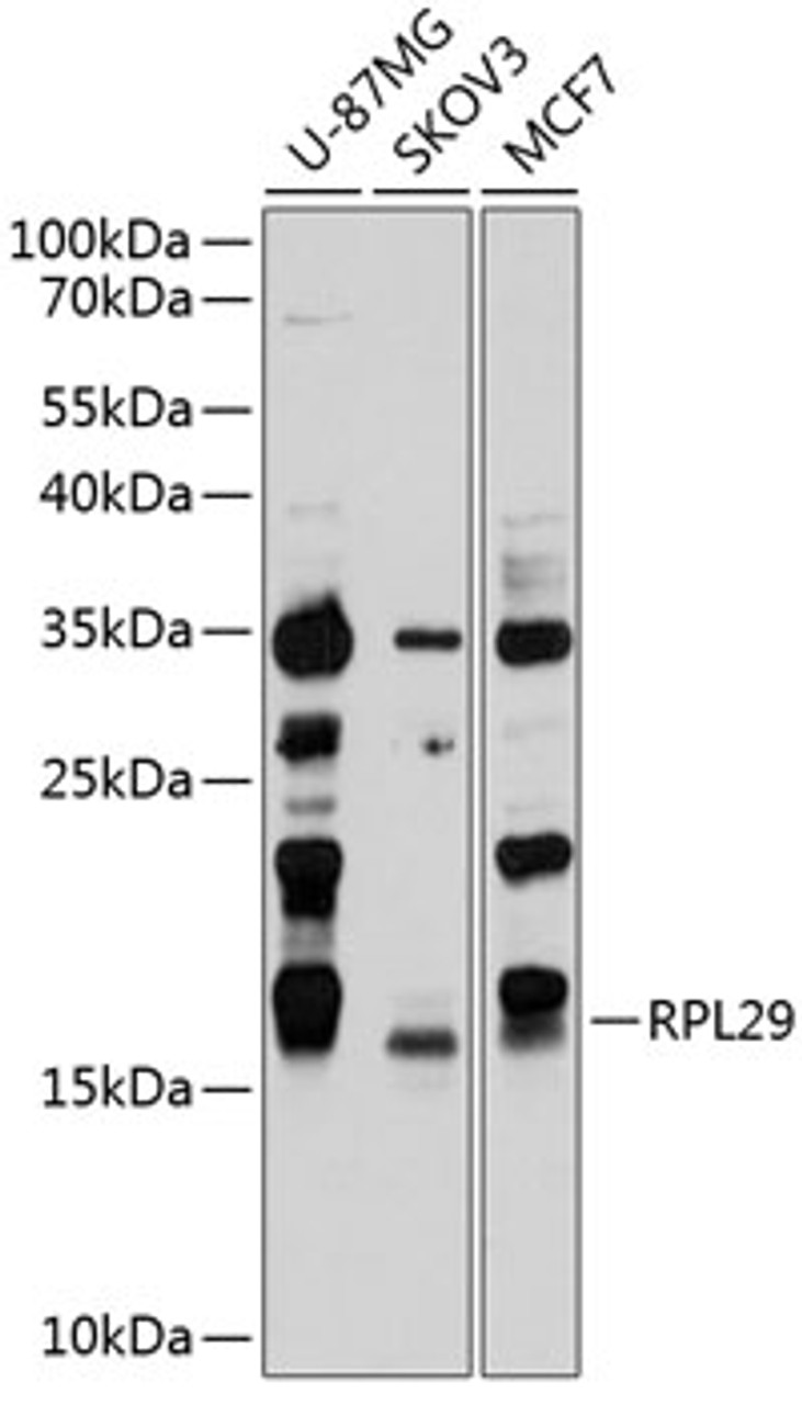 Western blot analysis of extracts of various cell lines, using RPL29 antibody (23-802) at 1:1000 dilution.<br/>Secondary antibody: HRP Goat Anti-Rabbit IgG (H+L) at 1:10000 dilution.<br/>Lysates/proteins: 25ug per lane.<br/>Blocking buffer: 3% nonfat dry milk in TBST.<br/>Detection: ECL Basic Kit.<br/>Exposure time: 90s.