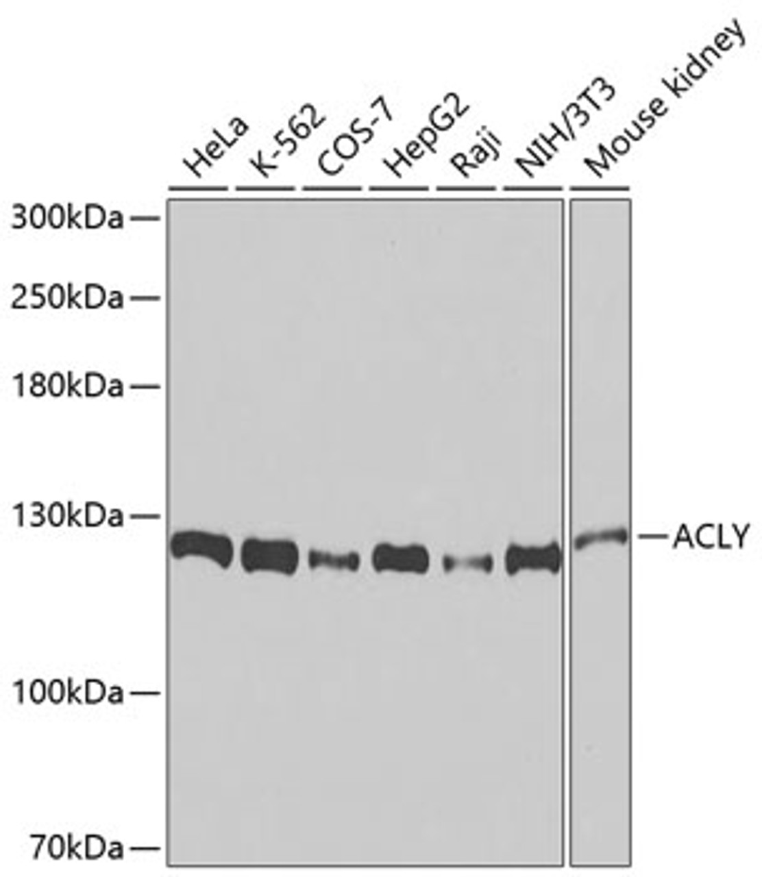 Western blot analysis of extracts of various cell lines, using ACLY antibody (23-966) at 1:1000 dilution.<br/>Secondary antibody: HRP Goat Anti-Mouse IgG (H+L) (AS003) at 1:10000 dilution.<br/>Lysates/proteins: 25ug per lane.<br/>Blocking buffer: 3% nonfat dry milk in TBST.<br/>Detection: ECL Basic Kit.<br/>Exposure time: 10s.