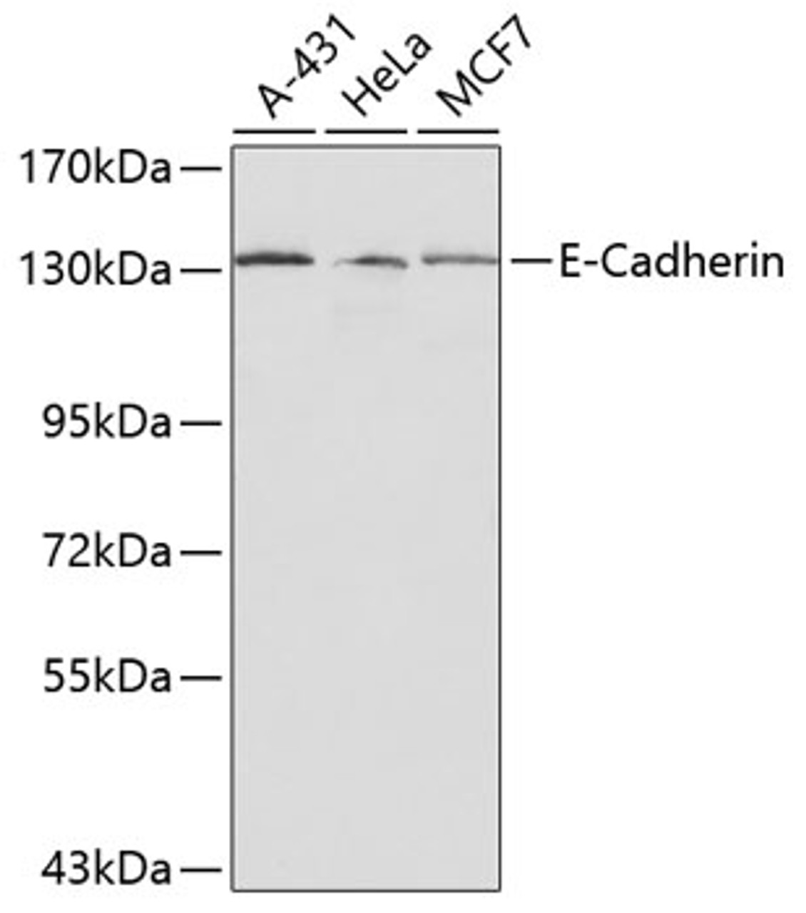 Western blot analysis of extracts of various cell lines, using E-Cadherin antibody (13-141) .<br/>Secondary antibody: HRP Goat Anti-Rabbit IgG (H+L) at 1:10000 dilution.<br/>Lysates/proteins: 25ug per lane.<br/>Blocking buffer: 3% nonfat dry milk in TBST.