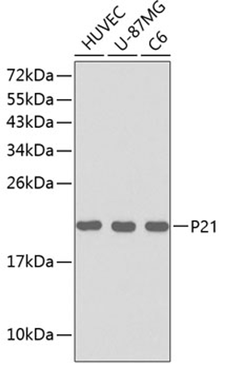 Western blot analysis of extracts of various cell lines, using P21 antibody (13-142) .<br/>Secondary antibody: HRP Goat Anti-Rabbit IgG (H+L) at 1:10000 dilution.<br/>Lysates/proteins: 25ug per lane.<br/>Blocking buffer: 3% nonfat dry milk in TBST.