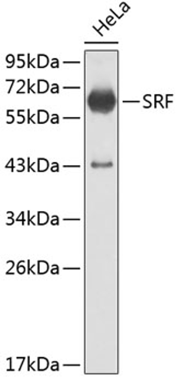 Western blot analysis of extracts of HeLa cells, using SRF antibody (13-166) .<br/>Secondary antibody: HRP Goat Anti-Rabbit IgG (H+L) at 1:10000 dilution.<br/>Lysates/proteins: 25ug per lane.<br/>Blocking buffer: 3% nonfat dry milk in TBST.