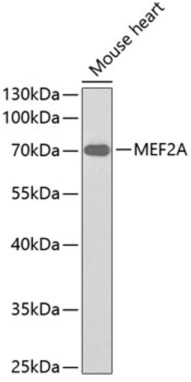 Western blot analysis of extracts of mouse heart, using MEF2A antibody (13-299) .<br/>Secondary antibody: HRP Goat Anti-Rabbit IgG (H+L) at 1:10000 dilution.<br/>Lysates/proteins: 25ug per lane.<br/>Blocking buffer: 3% nonfat dry milk in TBST.