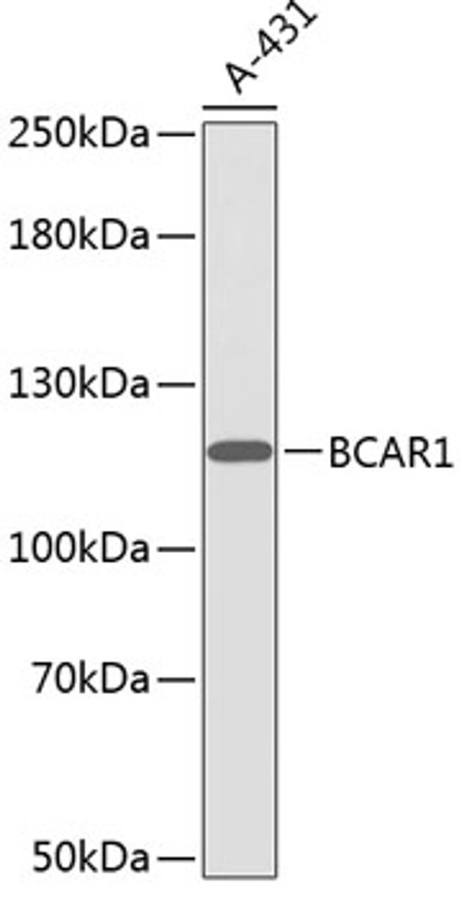 Western blot analysis of extracts of A-431 cells, using BCAR1 antibody (13-304) .<br/>Secondary antibody: HRP Goat Anti-Rabbit IgG (H+L) at 1:10000 dilution.<br/>Lysates/proteins: 25ug per lane.<br/>Blocking buffer: 3% nonfat dry milk in TBST.