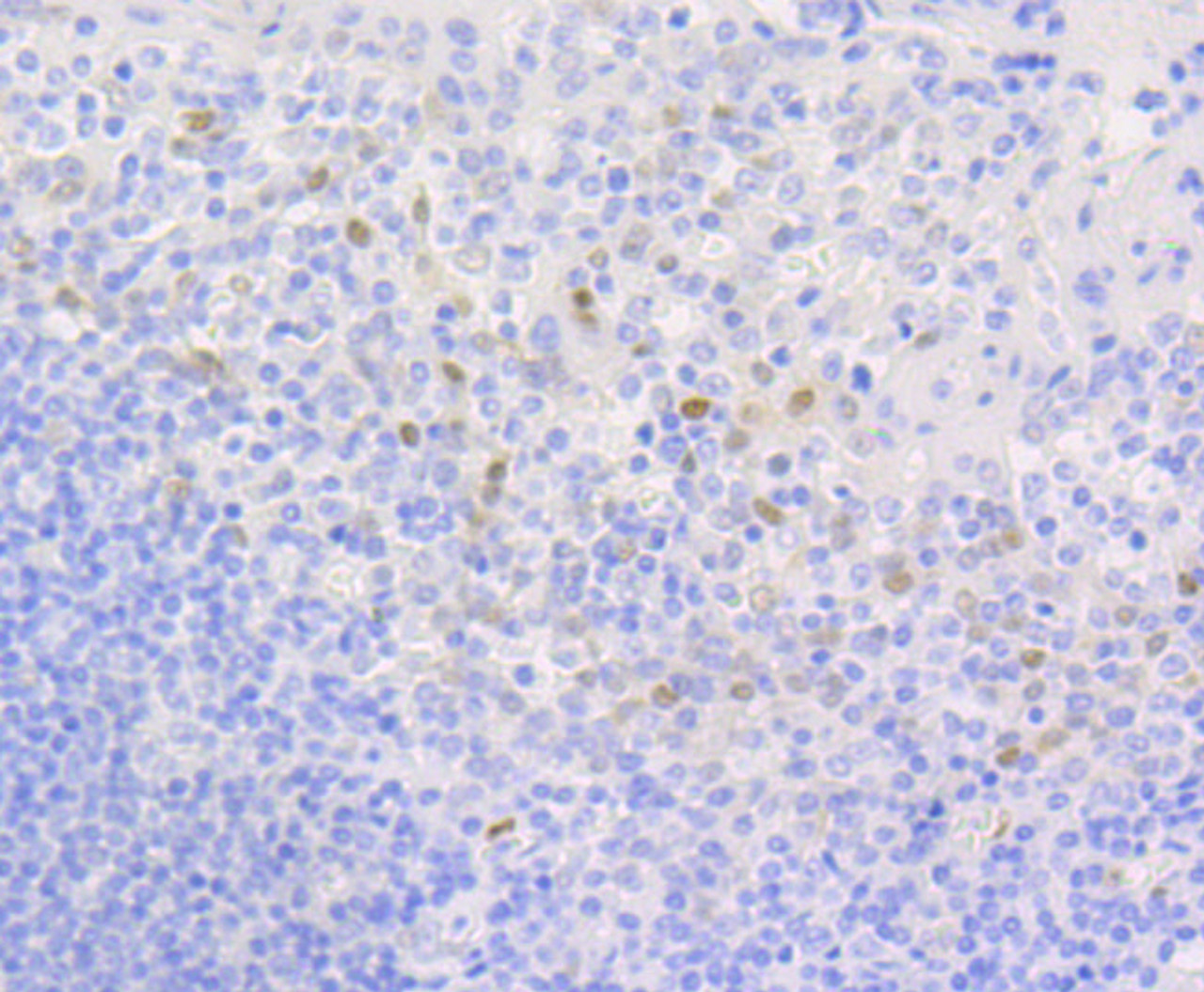 Immunohistochemistry of paraffin-embedded human tonsil using Cyclin D1 antibody (13-786) at dilution of 1:100 (40x lens) .