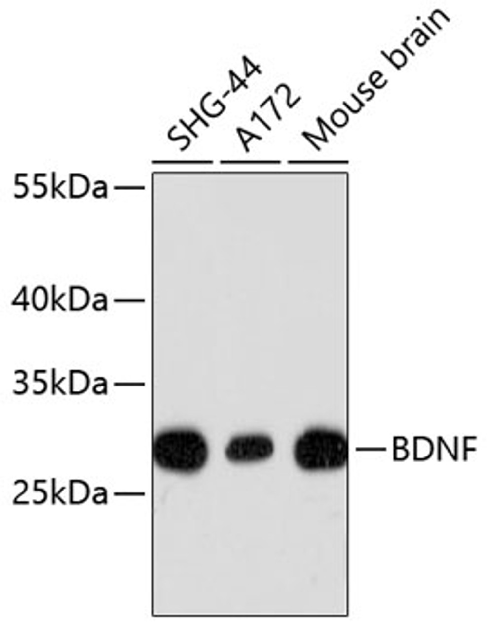 Western blot analysis of extracts of various cell lines, using BDNF antibody (13-788) .<br/>Secondary antibody: HRP Goat Anti-Rabbit IgG (H+L) at 1:10000 dilution.<br/>Lysates/proteins: 25ug per lane.<br/>Blocking buffer: 3% nonfat dry milk in TBST.