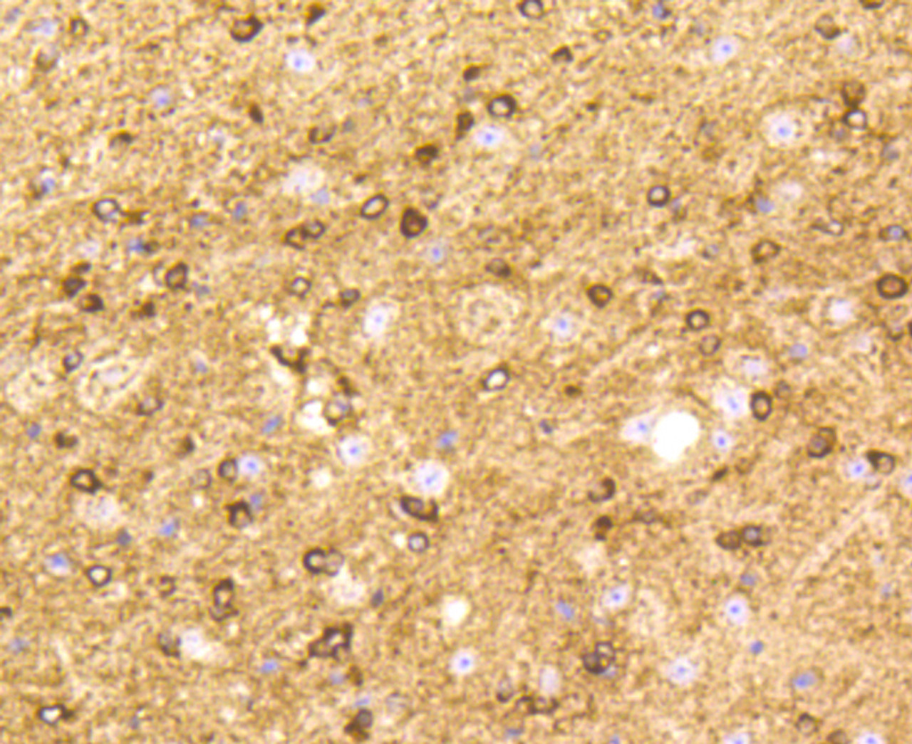 Immunohistochemistry of paraffin-embedded mouse brain using BDNF antibody (13-788) at dilution of 1:100 (40x lens) .
