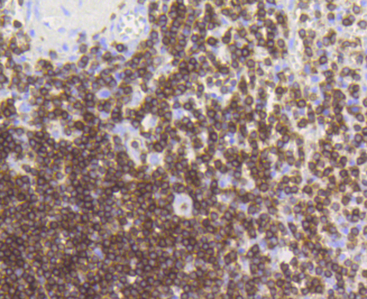 Immunohistochemistry of paraffin-embedded human spleen using CD3E antibody (13-801) at dilution of 1:100 (40x lens) .