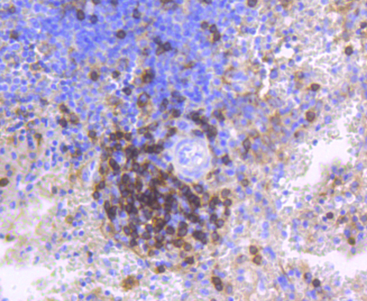 Immunohistochemistry of paraffin-embedded human spleen using CD4 antibody (13-802) at dilution of 1:100 (40x lens) .