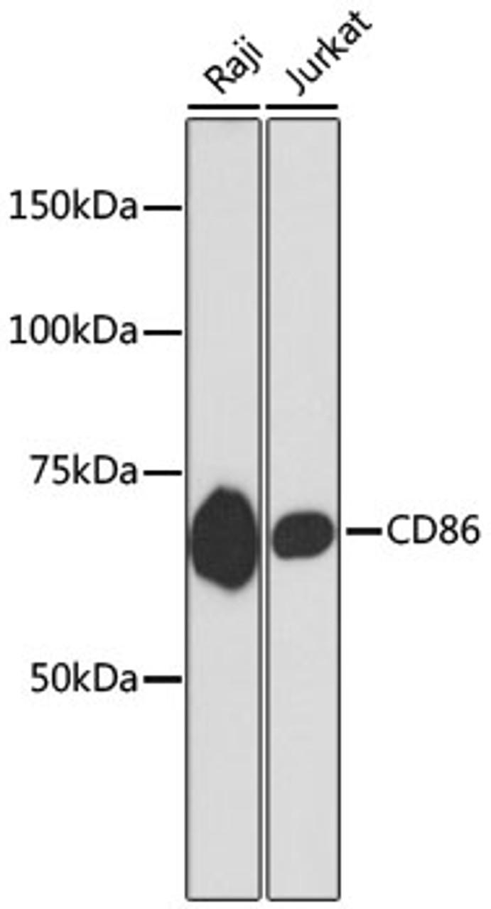 Western blot analysis of extracts of various cell lines, using CD86 antibody (13-807) .<br/>Secondary antibody: HRP Goat Anti-Rabbit IgG (H+L) at 1:10000 dilution.<br/>Lysates/proteins: 25ug per lane.<br/>Blocking buffer: 3% nonfat dry milk in TBST.